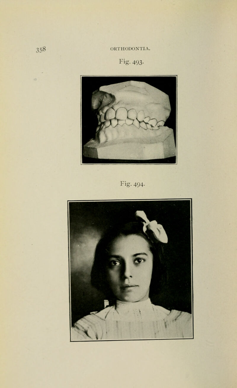 Fig- 493-