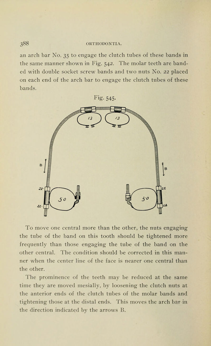 an arch bar No. 35 to engage the clutch tubes of these bands in the same manner shown in Fig. 542. The molar teeth are band- ed with double socket screw bands and two nuts No. 22 placed on each end of the arch bar to engage the clutch tubes of these bands. Fig- 545- To move one central more than the other, the nuts engaging the tube of the band on this tooth should be tightened more Frequently than those engaging the tube of the band on the other central. The condition should be corrected in this man- ner when the center line of the face is nearer one central than the other. The prominence of the teeth may be reduced at the same time they are moved mesially, by loosening the clutch nuts at the anterior ends of the clutch tubes of the molar bands and tightening those at the distal ends. This moves the arch bar in the direction indicated bv the arrows l>.