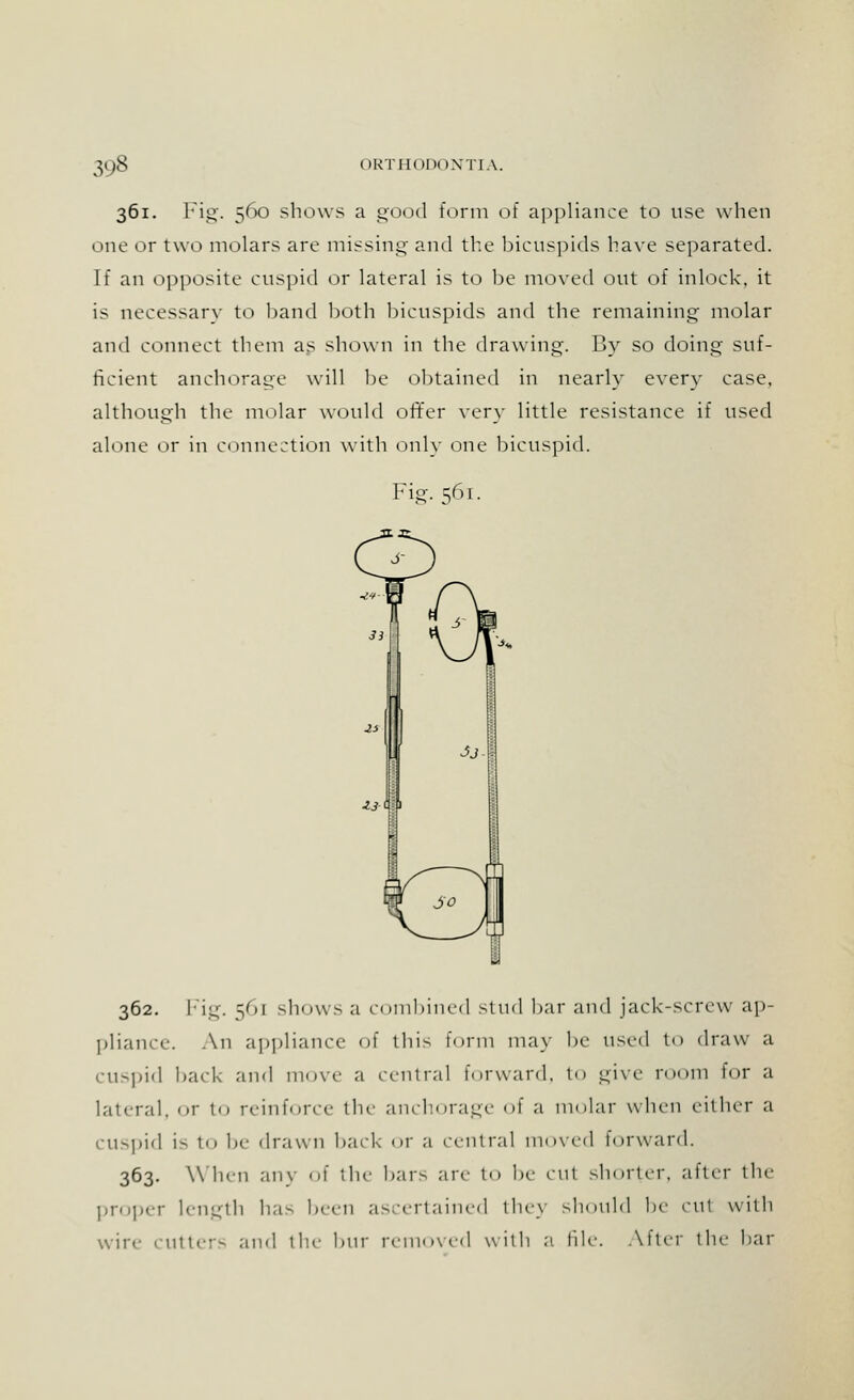 361. Fig. 560 shows a good form of appliance to use when one or two molars are missing and the bicuspids have separated. If an opposite cuspid or lateral is to be moved out of inlock, it is necessary to hand both bicuspids and the remaining molar and connect them as shown in the drawing. By so doing- suf- ficient anchorage will be obtained in nearly every case, although the molar would offer very little resistance if used alone or in connection with only one bicuspid. Fig. 561. 362. Fig. 56] sh<»ws a combined stud bar and jack-screw ap- pliance. An appliance of this form may be used to draw a cuspid hack and move a central forward, to give room For a lateral, or to reinforce the anchorage of a molar when cither a cuspid is to be drawn back or a central moved Forward. 363. When any of the bars arc to be cul shorter, after the proper length has been ascertained they should be cut with wire cutters and the bur removed with a file. Alter tin- bar