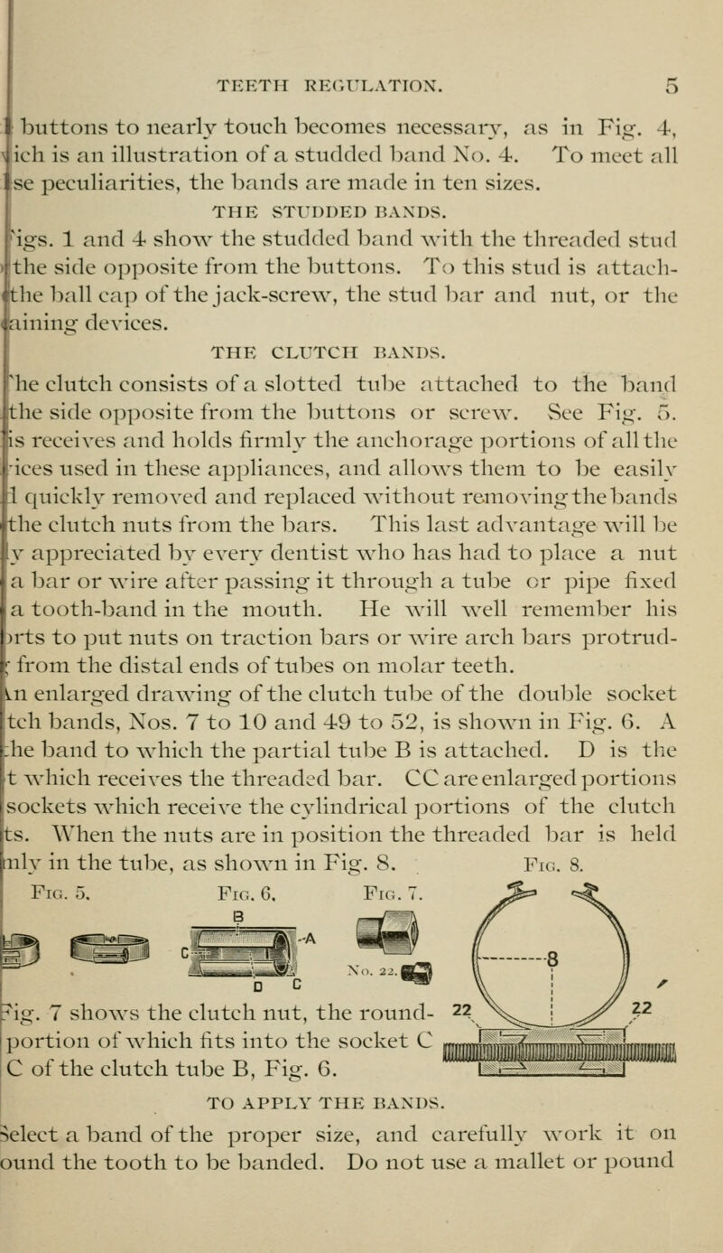 buttons to nearly touch becomes necessaiy, as in Fig-. 4, ich is an illustration of a studded band No. 4. To meet all [se peculiarities, the bands are made in ten sizes. THE STUDDED BANDS. 'igs. 1 and 4 sIioav the studded band Avith the threaded stud the side opposite from the buttons. To this stud is attach- the ball cap of the jack-screw, the stud bar and nut, or the aining devices. THE CLUTCH BANDS. 'he clutch consists of a slotted tube attached to the band the side op])osite from the buttons or screw. See Fig. 5. is receives and holds firmly the iinchorage portions of all the 'ices used in these appliances, and allows them to be easily i quickly removed and replaced Avithout removing the bands the clutch nuts from the bars. This last advantage will be y appreciated by every dentist who has had to place a nut a bar or wire after passing it through a tube or pipe fixed a tooth-band in the mouth. He Avill well remember his )rts to put nuts on traction bars or wire arch bars protrud- ^ from the distal ends of tubes on molar teeth. in enlarged drawing of the clutch tube of the double socket tell bands, Nos. 7 to 10 and 49 to 52, is shown in Fig. 6. A he band to which the partial tube B is attached. D is the t Avhich receives the threaded bar. CC are enlarged portions sockets Avhich receive the cylindrical portions of the clutch ts. When the nuts are in position the threaded bar is held nly in the tube, as shown in Fig. 8. Fig. 5, Fig. G. Fig. 7. B X(l. 2-'. I Fig. 8. € ?ig. 7 shows the clutch nut, the round- portion of \vhich fits into the socket C C of the clutch tube B, Fig. 6. TO APPLY THE BANDS. select a band of the proper size, and carefully work it on ound the tooth to be banded. Do not use a mallet or pound