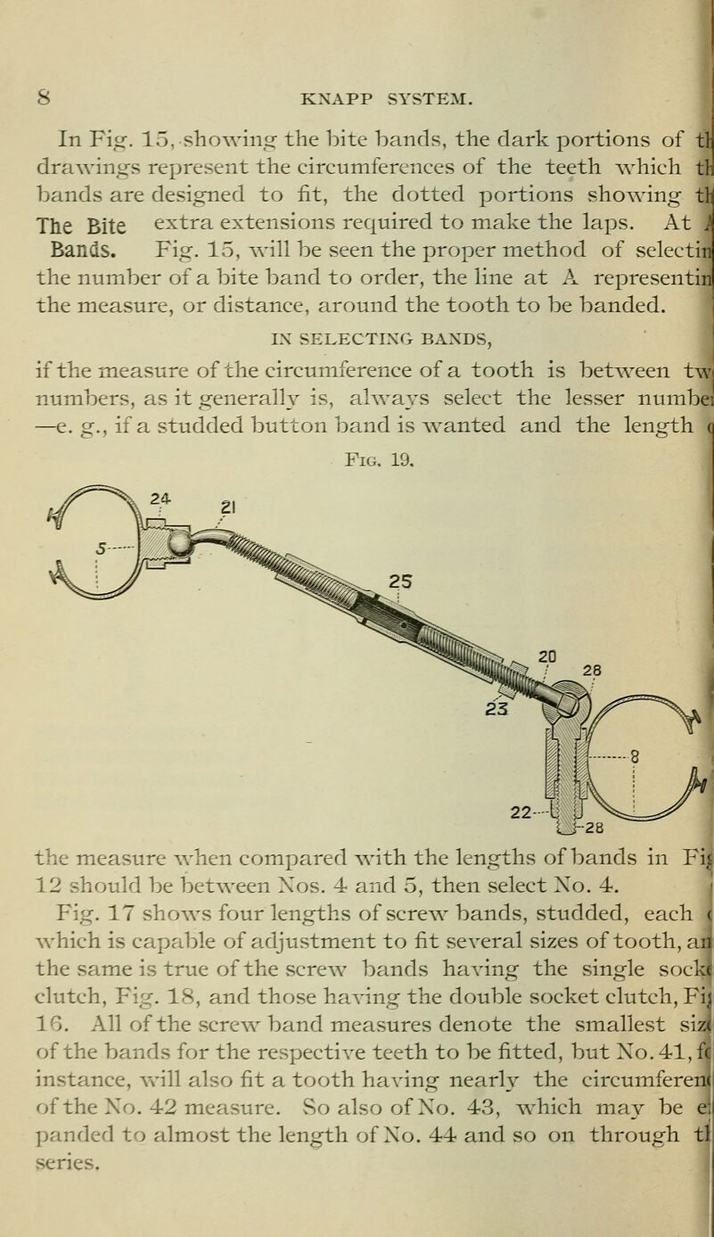 In Fig. lo,showin2: the bite bands, the dark portions of tl dra\vings represent the circumferences of the teeth which tl: bands are designed to fit, the dotted portions vshowing tli The Bite extra extensions required to make the laps. At } Bands. Fig. 15, will be seen the proper method of selectin the number of a bite band to order, the line at A representin the measure, or distance, around the tooth to be banded. j IN SELECTING BANDS, ' if the measure of the circumference of a tooth is between t\\\ numbers, as it generally is, always select the lesser numbei —e. g., if a studded button band is ^wanted and the length c Fig, 19. LJ-28 the measure Avhen compared with the lengths of bands in Fi^ 12 should be between Nos. 4 and 5, then select Xo. 4. Fig. 17 shows four lengths of screw bands, vStudded, each ( Avhich is capable of a.djustment to fit several sizes of tooth, an the same is true of the screw bands having the single socke clutch. Fig. 18, and those having the double socket clutch, Fij 16. All of the screw band measures denote the smallest vsiz( of the bands for the respective teeth to be fitted, but No. 41, fc instance, Avill also fit a tooth having nearly the circumferen( of the Xo. 42 measure. So also of Xo. 43, ^^hich may be e: panded to almost the length of Xo. 44 and so on through tl series.