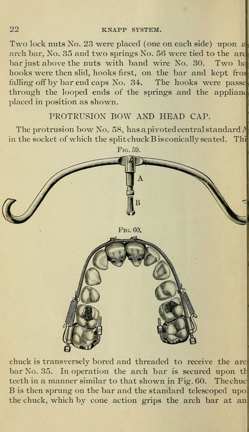 Two lock nuts No. 23 were placed (one on each side) upon arch bar, No. 35 and two springs No. 56 were tied to the arc bar just above the nuts -^^th band vsrire No. 30. Two be hooks ^vere then slid, hooks first, on the bar and kept froi falling off bj bar end caps No. 34. The hooks were passe through the looped ends of the springs and the applianc placed in position as sho^^n. PROTRUSION BOW AND HEAD CAP. The protrusion bow No, 58, has a pivoted central vStandard i^ in the socket of which the vSplit chuck B is conicallv seated. Thi Fig. 59. chuck is transversely bored and threaded to receive the arc bar No. 35. In operation the arch bar is secured upon tl teeth in a manner vsimilar to that shown in Fig. 60. Thechuc B is then sprung on the bar and the standard telescoped upo the chuck, which by cone action grips the arch bar at an