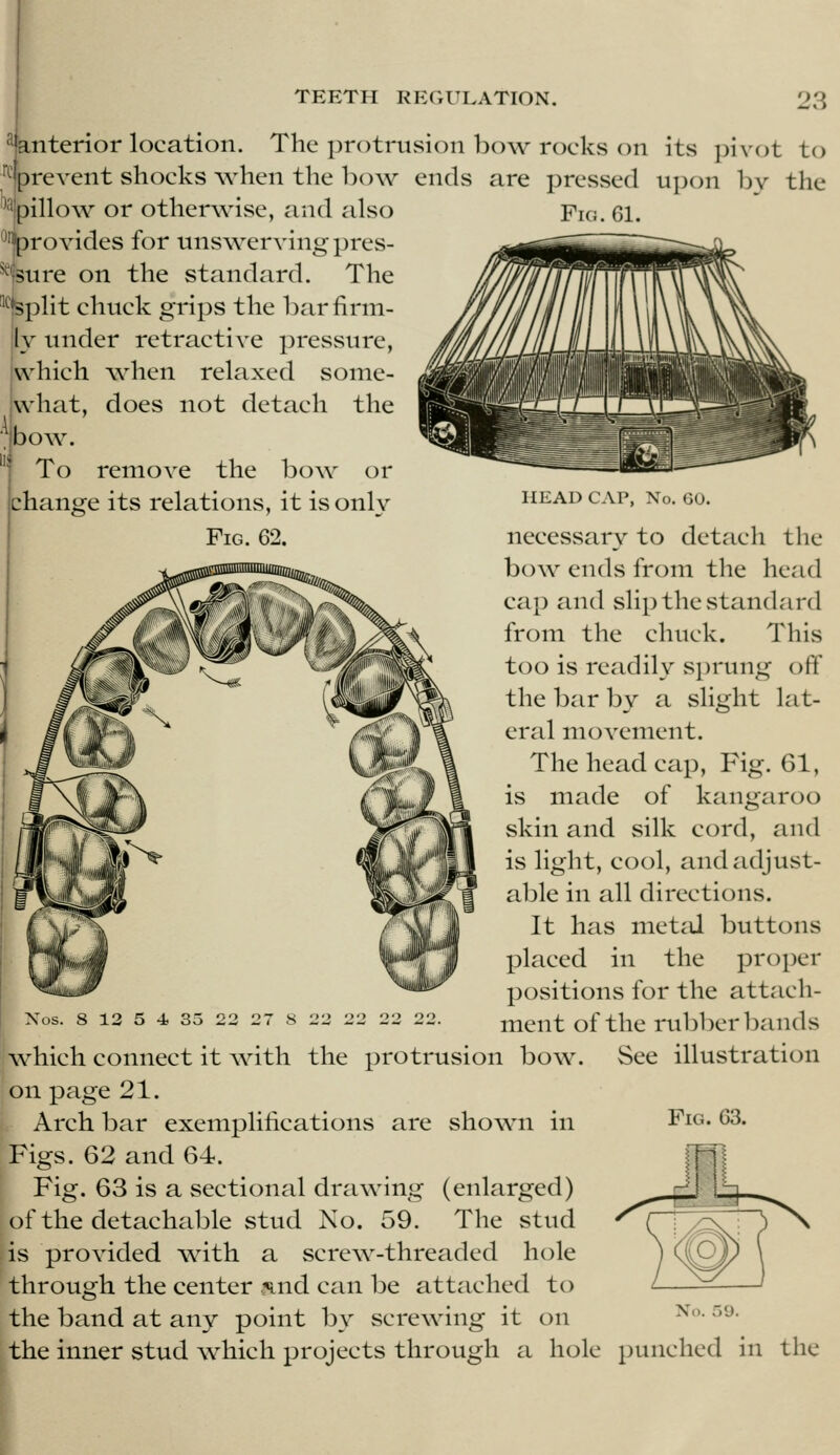 Fig. 61. ^anterior location. The protrusion bow rocks on its pivot to ■•■Iprevent shocks when the bow ends are preSvSed upon by the '%illow or otherwise, and also •^provides for uns\vervingpres- ^3ure on the standard. The '^'Split chuck grips the bar firm- ly under retractive pressure, which when relaxed some- what, does not detach the bow. To remove the bow or change its relations, it is onlv HEAD CAP, No. GO. necessary to detach the bow ends from the head cap and slip the st^mdard from the chuck. This too is readily sprung oflf the bar by a slight lat- eral movement. The head cap. Fig. 61, is made of kangaroo skin and silk cord, and is light, cool, and adjust- able in all directions. It has mctiU buttons placed in the proper positions for the attach- ment ofthe rubberbands See illustration Fig. 63. Xos. 8 12 5 4 35 22 27 8 22 22 22 22. which connect it \vith the protrusion bow. on page 21. Arch bar exemplifications are shown in Figs. 62 and 64. Fig. 63 is a sectional drawing (enlarged) of the detachable stud No. 59. The stud is provided w4th a screw-threaded hole through the center and can be attiiched to the band at any point by screwing it on the inner stud which projects through a hole punched in the No.