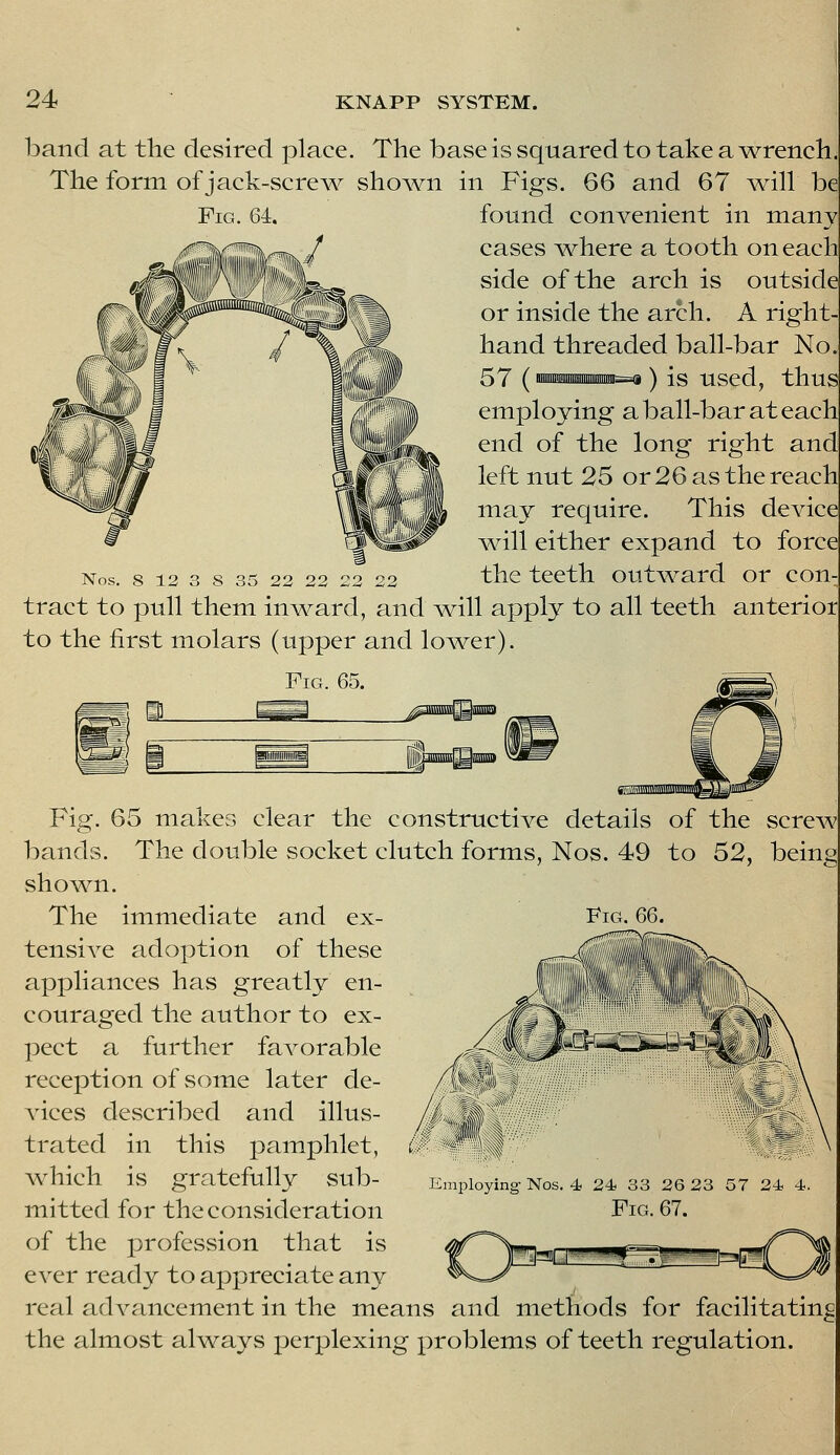 Fig. 64. iDand at the desired place. The base is squared to take a ^wrench. The form of jack-sere v^ shoAvn in Figs. 66 and 67 ^vvill be found convenient in many cases v^here a tooth on each side of the arch is outside or inside the arch. A right- hand threaded ball-bar No. 57 (iMMimiimi^^ ) is used, thus employing a ball-bar at each end of the long right and left nut 25 or 26 as the reach may require. This device ^dll either expand to force the teeth out^ward or con^ tract to pull them invrard, and v^ill apply to all teeth anterior to the first molars (upper and lo^sver). Fig. 65. Fig. 65 makes clear the constructive details of the scre^v bands. The double socket clutch forms, Nos. 49 to 52, beini shoAvn. The immediate and ex- Fig. 66. tensive adoption of these appliances has greatly en- couraged the author to ex- pect a further fa^^ or able reception of some later de- \4ces described and illus- trated in this pamphlet, Avhich is gratefully sub- mitted for the consideration of the profession that is ever ready to appreciate any real advancement in the means and methods for facilitating the almost aWays perplexing problems of teeth regulation. Employing Nos. 4, 24 33 26 23 57 24 4. Fig. 67.