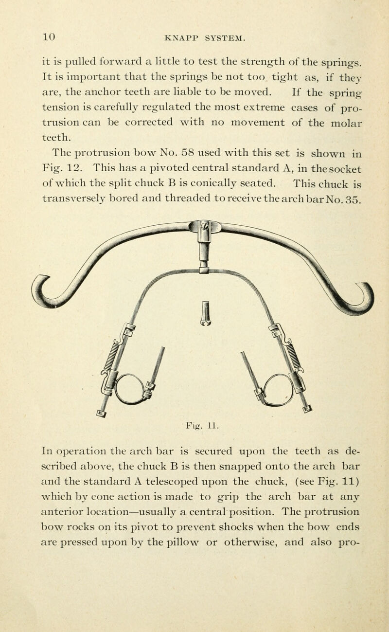 it is pulled forward a little to test the strength of the springs. It is important that the springs be not too tight as, if they are, the anchor teeth are liable to be moved. If the spring tension is carefully regulated the most extreme cases of pro- trusion can be corrected with no movement of the molar teeth. The protrusion bow No. 58 used w^ith this set is shown in Fig. 12. This has a pivoted central standard A, in the socket of which the split chuck B is conically seated. This chuck is transversely bored and threaded to receive the arch bar No. 35. Fig. 11. In operation the arch bar is secured upon the teeth as de- scribed above, the chuck B is then snapped onto the arch bar and the standard A telescoped upon the chuck, (see Fig. 11) w^hich by cone action is made to grip the arch bar at an3^ anterior location—usually a central position. The protrusion bow rocks on its pivot to prevent shocks w^hen the bow ends are pressed upon by the pillow or otherwise, and also pro-