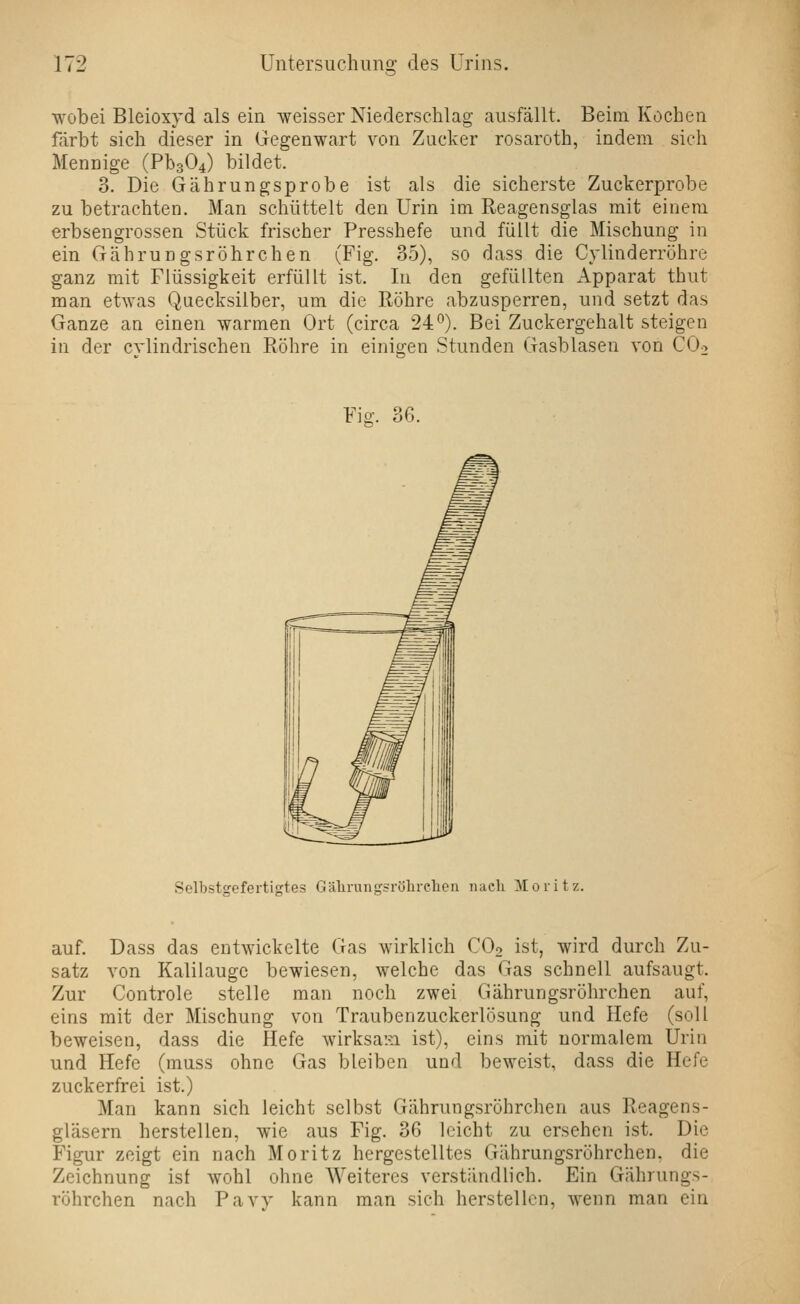 wobei Bleioxyd als ein weisser Niederschlag ausfällt. Beim Kochen färbt sich dieser in Gegenwart von Zucker rosaroth, indem sich Mennige (Ph304) bildet. 3. Die Gährungsprobe ist als die sicherste Zuckerprobe zu betrachten. Man schüttelt den Urin im Reagensglas mit einem erbsengrossen Stück frischer Presshefe und füllt die Mischung in ein Gährungsröhrchen (Fig. 35), so dass die Cylinderröhre ganz mit Flüssigkeit erfüllt ist. In den gefüllten Apparat thut man etwas Quecksilber, um die Röhre abzusperren, und setzt das Ganze an einen warmen Ort (circa 24°). Bei Zuckergehalt steigen in der cvlindrischen Röhre in einio-en Stunden Gasblasen von CÜ> Fig. 36. Selbsteefertistes Gälirungsröhrelien nacli Moritz. auf. Dass das entwickelte Gas wirklich CO2 ist, wird durch Zu- satz von Kalilauge bewiesen, welche das Gas schnell aufsaugt. Zur Controle stelle man noch zwei Gährungsröhrchen auf, eins mit der Mischung von Traubenzuckerlösung und Hefe (soll beweisen, dass die Hefe wirksam ist), eins mit normalem Urin und Hefe (muss ohne Gas bleiben und beweist, dass die Hefe zuckerfrei ist.) Man kann sich leicht selbst Gährungsröhrchen aus Reagens- gläsern herstellen, wie aus Fig. 36 leicht zu ersehen ist. Die Figur zeigt ein nach Moritz hergestelltes Gährungsröhrchen, die Zeichnung ist wohl ohne Weiteres verständlich. Ein Gährungs- röhrchen nach Pavy kann man sich herstellen, wenn man ein