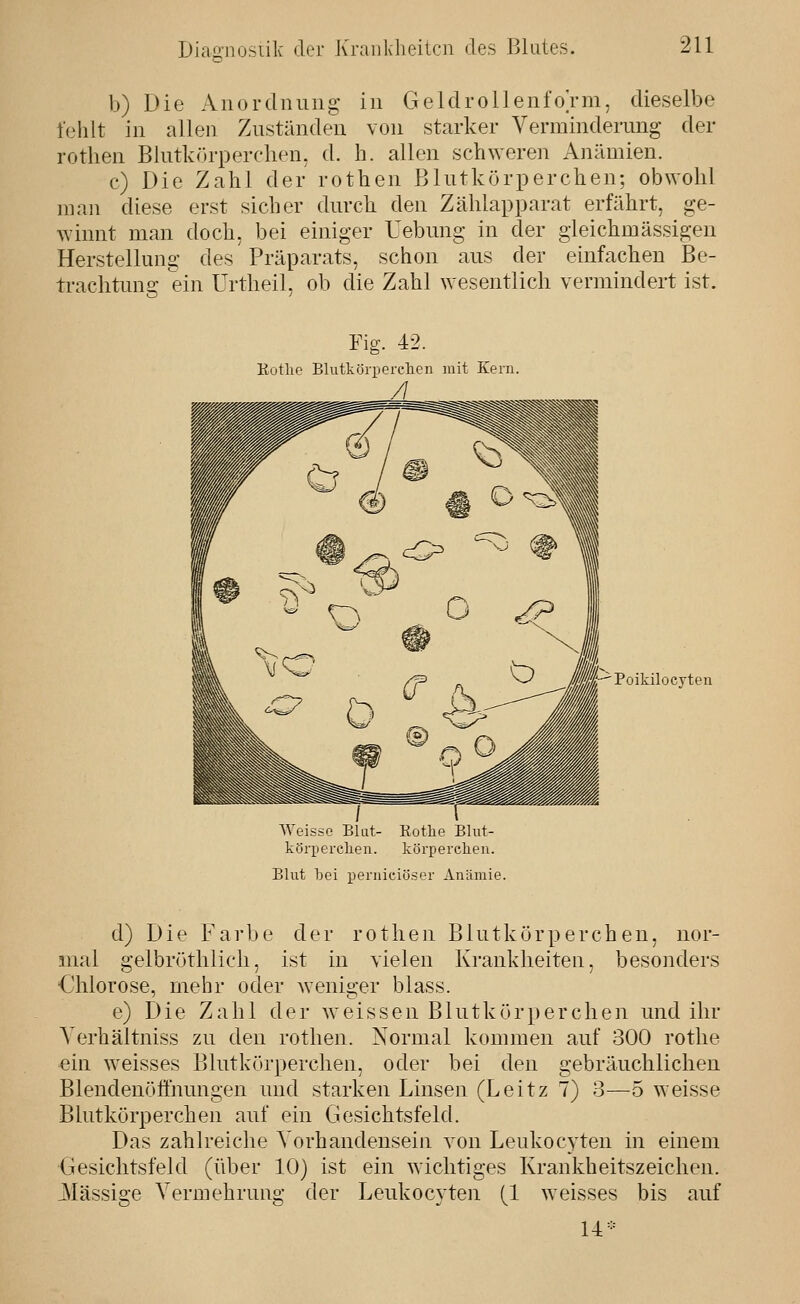 b) Die Anordiiung in GeldroilenfoVm, dieselbe fehlt in allen Zuständen von starker Verminderung der rotlien Blutkörperchen, d. h. allen sch^Yeren Anämien. c) Die Zahl der rothen Blutkörperchen; ob\Yolil man diese erst sicher durcli den Zählapparat erfährt, ge- winnt man doch, bei einiger Uebung in der gleichmässigen Herstellung des Präparats, schon aus der einfachen Be- trachtuns: ein Urtheil. ob die Zahl Nvesentlich vermindert ist. Fig. 42. Kotlie Blutkörperclicn mit Kern. A Poikilocyteii / r Weisse Blat- Kothe Blut- körperehen. körperehen. Blut bei peniieiöser Anämie. d) Die Farbe der rothen Blutkörperchen, nor- mal gelbröthlicli, ist in vielen Krankheiten, besonders Ohiorose, mehr oder weniger blass. e) Die Zahl der weissen Blutkörperchen und ihr Yerhältniss zu den rothen. Normal kommen auf 300 rotlie ein weisses Blutkörperchen, oder bei den gebräuchlichen Blendenöfthungen und starken Linsen (Leitz 7) 3—5 weisse Blutkörperchen auf ein Gesichtsfeld. Das zahlreiche Vorhandensein von Leukoc5^teu in einem Gesichtsfeld (über 10) ist ein wichtiges Krankheitszeichen. der Leukocyten (1 weisses bis auf Massige Vermehrung U^