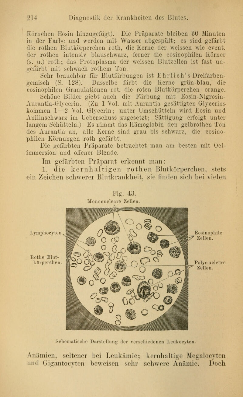 Küriichen Eosin hinzugefügt). Die Präparate bleiben 30 Minuten in der Farbe und werden mit Wasser abgespült: es sind gefärbt die rothen Blutkörperchen roth, die Kerne der weissen wie event. der rothen intensiv blauschwarz, ferner die eosinophilen Körner (s. u.) roth; das Protoplasma der weissen Blutzellen ist fast un- gefärbt mit schwach rothem Ton. Sehr brauchbar für Blutfärbungen ist Ehrlich's Dreifarben- gemisch (S. 128). Dasselbe färbt die Kerne grün-blau, die eosinophilen Granulationen rot. die roten Blutkörperchen orange. Schöne Bilder giebt auch die Färbung mit Eosin-Nigrosin- Aurantia-Glycerin. (Zu 1 Vol. mit Aurantia gesättigten Glycerins kommen 1—2 Vol. Glvcerin; unter Umschütteln wird Eosin und Anilinschwarz im Ueberschuss zugesetzt; Sättigung erfolgt unter langem Schütteln.) Es nimmt das Hämoglobin den gelbrothen Ton des Aurantia an, alle Kerne sind grau bis schwarz, die eosino- philen Körnungen roth gefärbt. Die gefärbten Präparate betrachtet man am besten mit Oel- immersion und offener Blende. Im gefärbten Präpai'at erkennt man: 1. die kernhaltigen rothen Blutkörperchen, stets ein Zeichen scliwerer Blntkrankheit. sie finden sich bei vielen Fig. 43. 3[ononneleüre Zellen. Lympliocyten ^ Schomatischc Darstellung der vorsehiedenen Lcukocyteu. Anämien, seltener bei Lenkämie; kernhaltige Megalocyten und Gigantocvten beweisen selir schwere Anämie, l^ocli