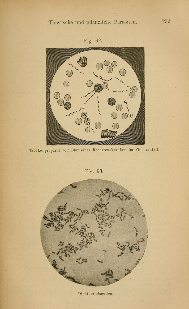 Fiff. 62. Trockenpräparat vom Bli\t eines Keeurrenskraiiken im Fieberanfall. Fig. 63. _^.«i»^^; 3 / \j «^-*- # ^ '*»^ W''^ SS* ; I J •^ i^^ 1 :.>- Diplitlierieljacillen.