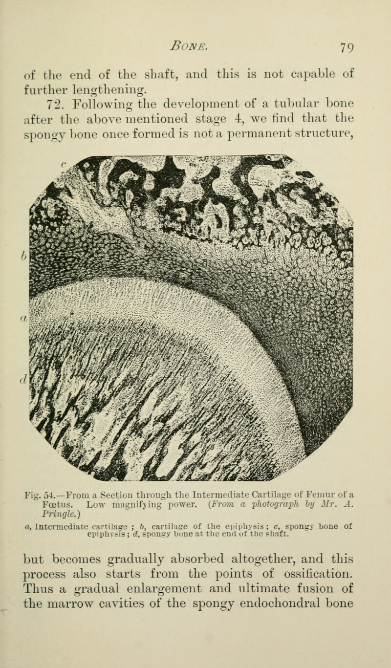 of the end of the shaft, and this is not capable of further lengthening. 72. Following the development of a tubular bone after the above mentioned stage 4, we find that the spongy bone once formed is not a permanent structure, Fig. 54.—From a Section through the Intermediate Cartilage of Femur of a Foetus. Low magnifjing power. {From a photogrcqjh by Mr. A. Pringle.) a, intermediate cartilajsre ; b, cartilage of the eiiiiihysis; c, spongy bone of epiphysFs; d, spongy bi>ne at the end of the shaft. but becomes gradually absorbed altogether, and this process also starts from the points of ossification. Thus a f;rc\dual enlargement and ultimate fusion of the marrow cavities of the spongy endochondral bone