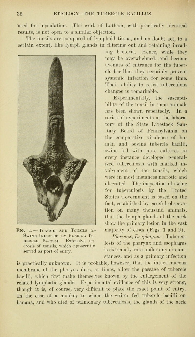used for inoculation. The work of Latham, with practically identical results, is not open to a similar objection. The tonsils are composed of lymphoid tissue, and no doubt act, to a certain extent, like lymph glands in fdtering out and retaining invad- ing bacteria. Hence, while they may be overwhelmed, and become avenues of entrance for the tuber- cle l)acilhis, they certainly prevent p^'stemic infection for some time. Their ability to resist tuberculous changes is remarkable. Experimentally, the suscepti- 1)ility of the tonsil in some animals has been shown repeatedly. In a series of experiments at the labora- tory of the State Livestock San- itary Board of Pennsylvania on the comparative virulence of hu- man and bovine tubercle bacilli, swine fed with jnire cultures in every instance developed general- ized tuberculosis with marked in- volvement of the tonsils, which were in most instances necrotic and ulcerated. The inspection of swine for tuberculosis by the United States Government is based on the fact, established by careful observa- tion on many thousand animals, that the lymph glands of the neck show the primary lesion in the vast majority of cases (Figs. 1 and 3). Pharynx, Esophagus.—Tubercu- losis of the pharynx and esophagus is extremely rare under any circum- stances, and as a primary infection is practically unknown. It is probable, however, that the intact mucous membrane of the pharynx does, at times, allow the passage of tubercle bacilli, which first make themselves known by the enlargement of the related lymphatic glands. Experimental evidence of this is very strong, though it is, of course, very difficult to place the exact point of entry. In the case of a monkey to whom the writer fed tubercle bacilli on banana, and who died of pulmonary tuberculosis, the glands of the neck r I Fig, 1. — Tongue and Tonsils op Swine Infected by Feeding Tu- bercle Bacilli. Extensive ne- crosis of tonsils, which apparently served as port of entry.