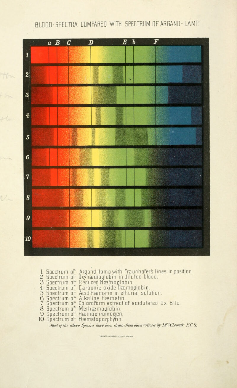 BLDDD-5PECTRA CDMPAREO WITH SPECTRUM DF ARGAND- LAMP 1 Spectrum oF Argand-lamp with FraunhDFers linES in position. 2 Spectmm dP DxyhsOTnglobin in diluted blaad. 3 Spectrum oF Reduced rfaama^lnbin 4 Spectrum or Carbonic oxide Haemoglobin. 5 Spectrum oP AcidHaama+m in ethenal solution. 6 Spectrum oP Alkaline Haamatm. 7 Spectrum oF CbiaroFnrm extract dF acidulated Dx-Bile. 8 Spectrum oF MethaBmo^lobin. 9 Spectrom oF HsmDchrDrnDi^En. 10 Spectrum oF Haematoporphynn. Most of the above Spectra funv been drawn from obsen'ations by MTWlepruik ECS'. SAGKErTfttflLHELHS LI