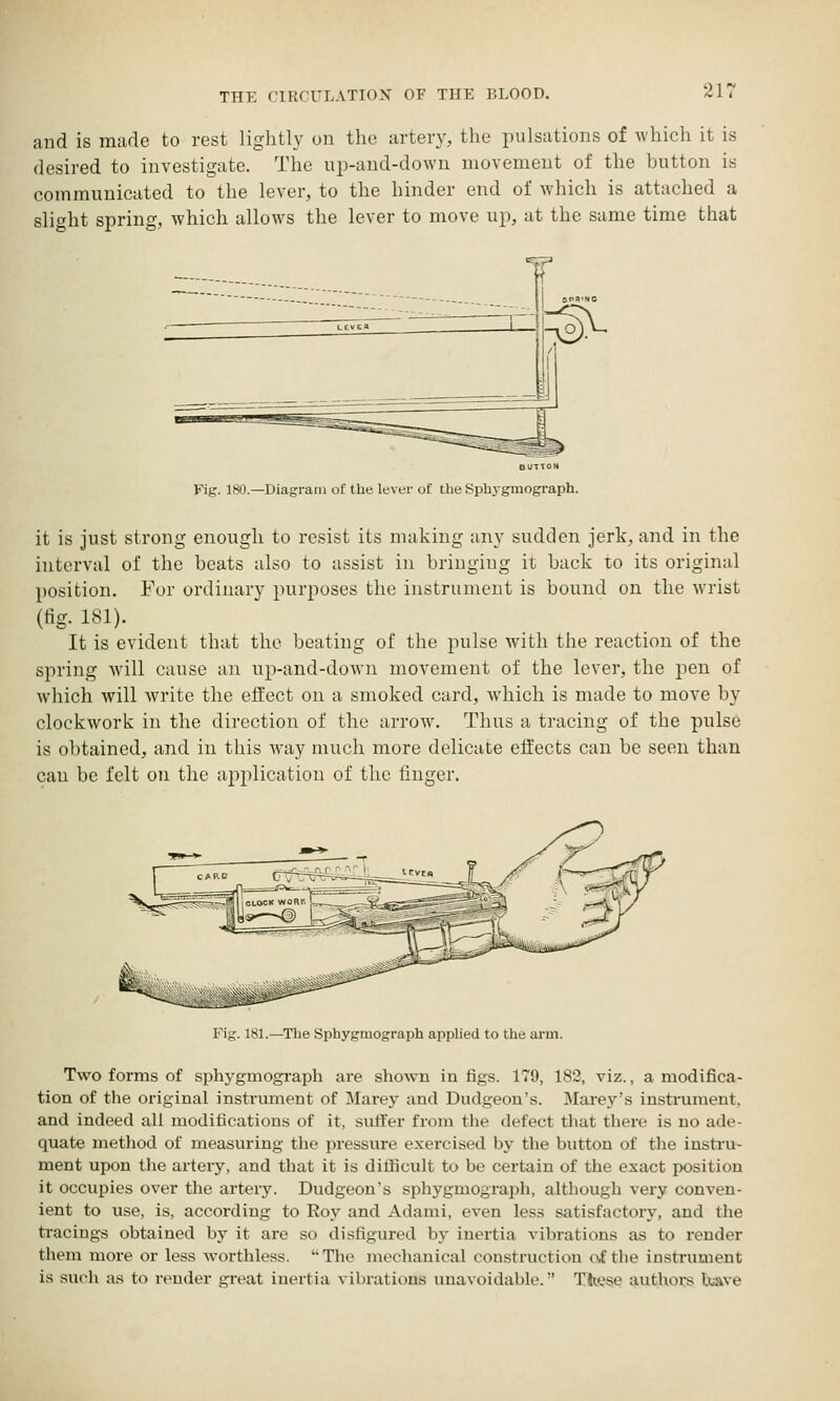 and is made to rest lightly on the artery, the pulsations of which it is desired to investigate. The up-and-down movement of the button is communicated to the lever, to the hinder end of which is attached a slight spring, which allows the lever to move up, at the same time that Fig. 180.—Diagram of the lever of the Sphygmograph. it is just strong enough to resist its making any sudden jerk, and in the interval of the beats also to assist in bringing it back to its original position. For ordinary purposes the instrument is bound on the wrist (fig. 181). It is evident that the beating of the pulse Avith the reaction of the spring will cause an up-and-down movement of the lever, the pen of which will write the effect on a smoked card, which is made to move by clockwork in the direction of the arrows Thus a tracing of the pulse is obtained, and in this way much more delicate effects can be seen than can be felt on the application of the finger. Fig. 181.—The Sphygmograph applied to the arm. Two forms of sphygmograph are shown in figs. 179, 182, viz., a modifica- tion of the original instrimient of Marey and Dudgeon's. Marey's instrument, and indeed all modifications of it, sufifer from the defect that there is no ade- quate method of measuring the pressure exercised by the button of the instru- ment upon the artery, and that it is difiicult to be certain of the exact position it occupies over the artery. Dudgeon's sphygmograph, although very conven- ient to use, is, according to Ro\^ and Adanii, even less satisfactory, and the tracings obtained by it are so disfigured by inertia vibrations as to render them more or less worthless. The mechanical construction cf the instrument is such as to render great inertia vibrations unavoidable. Tkese authoi,*s have