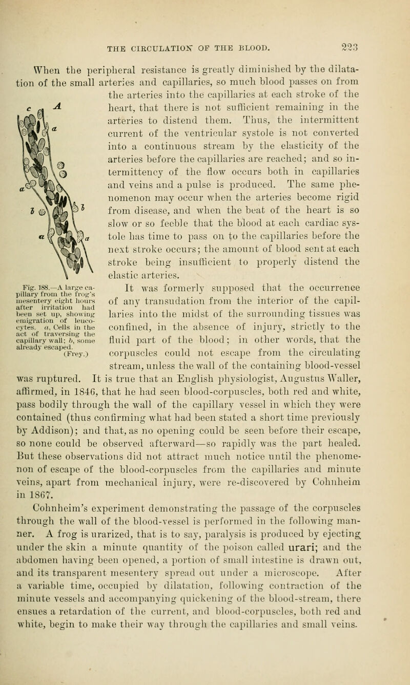 When the peripheral resistance is greatly diminished by the dilata- tion of the small arteries and capillaries, so mncli blood passes on from the arteries into the capillaries at each stroke of the heart, that there is not snflicient remaining in the arteries to distend them, Thns, the intermittent current of the ventricular systole is not converted into a continuous stream by the elasticity of the arteries before the capillaries are reached; and so in- Lermittency of the flow occurs botli in cai^illaries and veins and a pulse is produced. The same j^he- nomenon may occur when the arteries become rigid from disease, and when the beat of the heart is so slow or so feeble that the blood at each cardiac sys- tole has time to pass on to the capillaries before the next stroke occurs; the amount of blood sent at each stroke being insufficient to properly distend the elastic arteries. It was formerly supposed that the occurrence of any transudation from the interior of the capil- laries into the midst of the surrounding tissues was confined, in the absence of injury, strictly to the fluid part of the blood; in other words, that the corpuscles could not escape from the circulating stream, unless the wall of the containing blood-vessel was ruptured. It is true that an English physiologist, Augustus Waller, affii-med, in 1846, that he had seen blood-corpuscles, both red and white, pass bodily through the wall of the capillary vessel in which they were contained (thus confirming what had been stated a short time previously by Addison); and that, as no opening could be seen before their escape, so none could be observed -afterward—so rapidly was the part healed. But these observations did not attract much notice until the phenome- non of escape of the blood-corpuscles from the capillaries and minute veins, apart from mechanical injury, were re-discovered by Cohnheim in 1867. Cohnheim's experiment demonstrating the passage of the corpuscles through the wall of the blood-vessel is perfornu'd in the following man- ner. A frog is urarized, that is to say, paralysis is produced by ejecting under the skin a minute quantity of the poison called urari; and the abdomen having been opened, a portion of small intestine is drawn out, and its transparent mesentery spread out under a microscope. After a variable time, occuijied by dilatation, following contraction of the minute vessels and accompanying quickening of the blood-stream, there ensues a retardation of the current, and blood-corpuscles, both red and white, begin to make their way through the capillaries and small veins. Fig. 188.—A large ca- pillary froui the frog's mesentery eight hours utter iri'itatiou had heeu set up, showing emigration ot leueo- oytes. ((, Cells in the act of traversing the capillary wall; b, some already escaped. (Frey.;