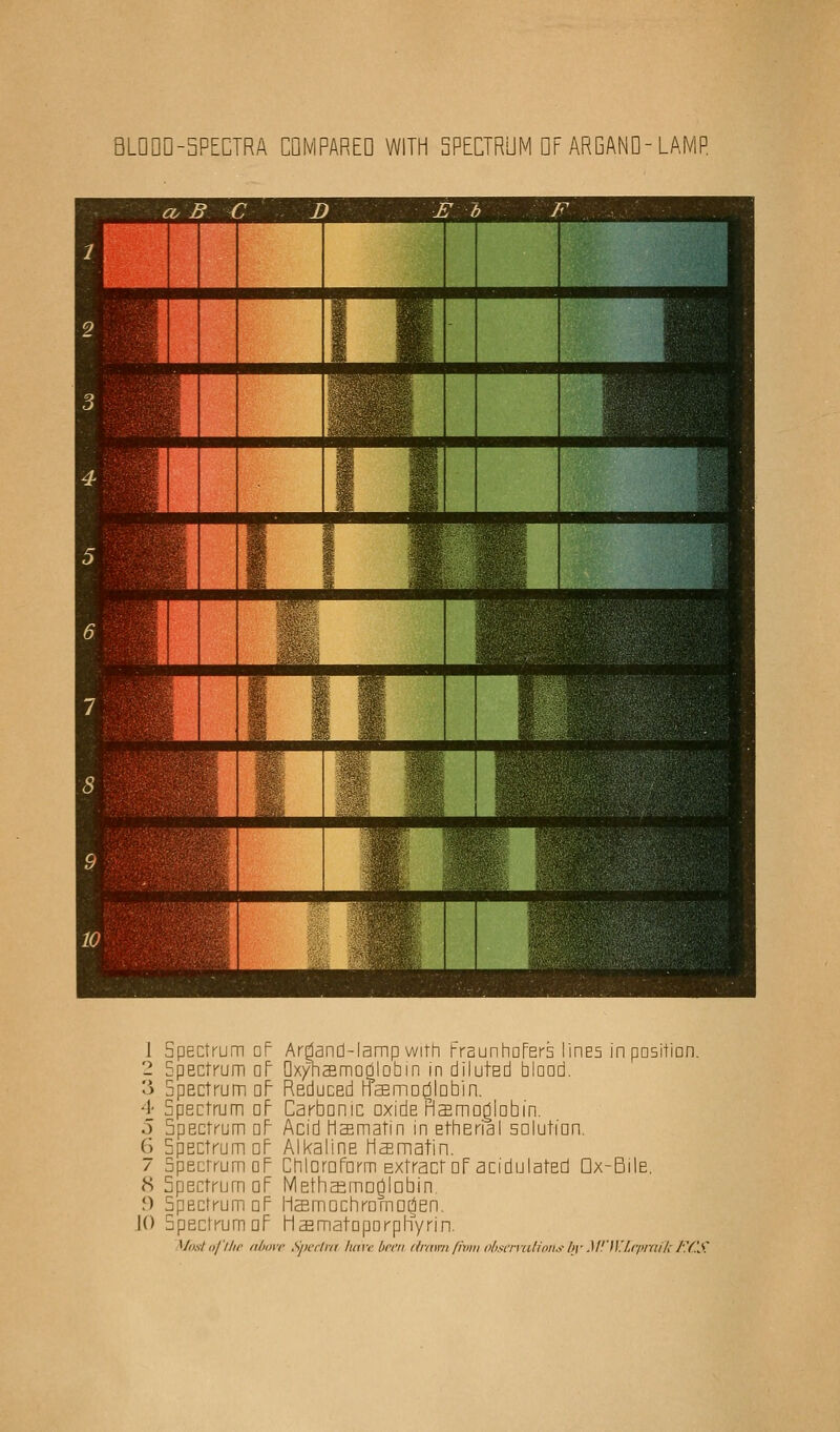 BL0QD-5PECTRA COMPARED WITH SPECTRUM DFARGANQ-LAf 1 Spectrum oP Ardand-lamp with Fraunhoters lines in position. 2 Spectrum oF Oxyhaemoqlobin in diluted blood. 3 5pectrum dP Reduced rTsemDCilobin. 4 Spectrum oF Carbonic oxide Haemoglobin. 5 Spectrum oP Acid liaematin in etherial solution. 6 Spectrum oP Alkaline Plsmatin. / Spectrum dF ChloroForm Extract nF acidulated Dx-Bile. 8 5pectrumaF MethafmoOjQbin. f) Spectrum dF Haemochromaden. 10 Spectrum oF PlaematoporpKyrin. \tad aj'tiie above Spectra hare been /{rami fivm observations by MTKIepraik ECS