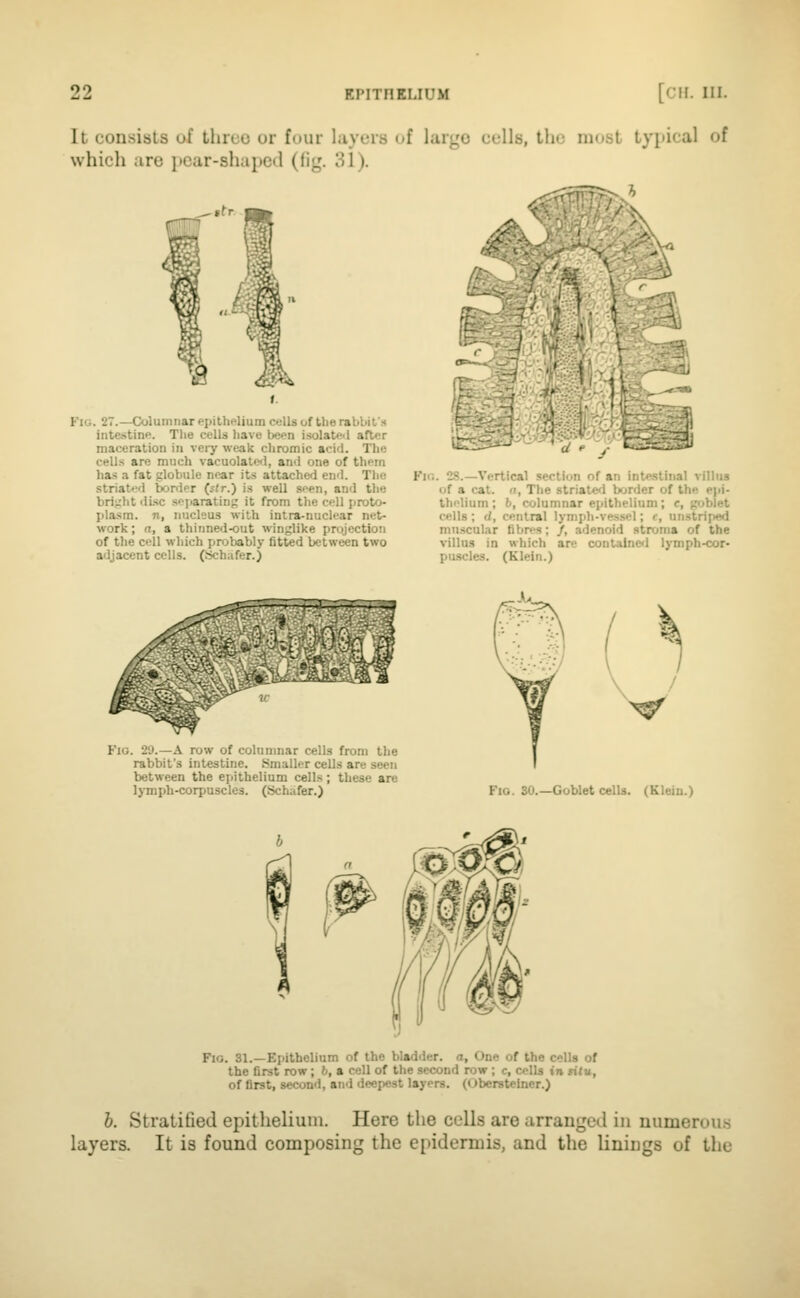 It consists of three or four layers of large cells, the most typical of which are ])car-shapcd (fig. 31). Fig. 27.—Columnar epithelium cells of the rabbit's intestine. The cells have been isolate<l after maceration in vei-y weak cliromic acid. The cells are much vacuolate*!, and one of them has a fat globule near its attached end. The striated border (^(r.) is well seen, and the bri;;htdi.sc sejiarating it from the cell proto- plasm. 71, nucleus with intra-nuclear net- work; a, a thinned-out winglike projection of the cell which probably fitted between two adjacent cells. (Schafer.) d f / Fir,. 2S.—Vertical section of an iiiu<uii.ii villus of a cat. n, Tlie striate*! border of the epi- thelium ; h, columnar epithelium; c, goblet cells ; </, central lymph-vessel; f, unstriped miiscul.ir fibres; /, adenoid stroma of the villus in which are contalncl lymph-cor- pu.scles. (Klein.) ii&flS^< Fig. i'J.—a row of columnar cells from the rabbit's intestine. Smaller cells are seen between the epithelium cells; these are lymph-corpuscles. (Schafer.) ^V Fig. 30.—Goblet cells. (Klein.) Fig. 31.—Epithelium of the bladder, a, One of the cells of the first row; 6, a cell of the second row ; c, cells in riJu, of first, second, and deepest layers. (Oberstelner.) 6. Stratified epithelium. Here tiie cells are arranged in numerous layers. It is found composing the epidermis, and the linings of the