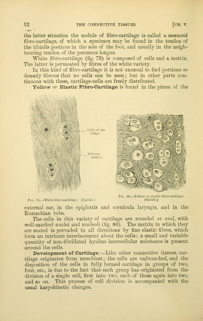 --.. ' the latter situation the nodule of fibro-cartilage is called a sesamoid fibro-cartilage, of which a specimen may be found in the tendon of the tibialis posticus in the sole of the foot, and usually in the neigh- bouring tendon of the peroneus longus. White fibro-cartilage (fig. 79) is composed of cells and a matrix. The latter is permeated by fibres of the white variety. In this kind of fibro-cartilage it is not unusual to find portions so densely fibrous that no cells can be seen; but in other parts con- tinuous with these, cartilage-cells are freely distributed. Yellow or Elastic Fibro-Cartilage is found in the pinna of the m: Cells of car- tilage. Fibrous matrix. '•;! ' 4 At I i,r'''''i'lMV ''^^ •■' •~*'\:- :iJ?U■-■ Fio. so.—Yellow or elastic fibro-cartilage. Fig. 79.—White fibro-cartilage. (Cadiat.) (Cadiat.) external ear, in the epiglottis and cornicula laryngis, and in the Eustachian tube. The cells in this variety of cartilage are rounded or oval, with well-marked nuclei and nucleoli (fig. 80). The matrix in which they are seated is pervaded in all directions by fine elastic fibres, which form an intricate interlacement about the cells: a small and variable quantity of non-fibrillated hyaline intercellular substance is present around the cells. Development of Cartilage.—Like other connective tissues, car- tilage originates from mesoblast; the cells are unbranched, and the disposition of the cells in fully formed cartilage in groups of two, four, etc., is due to the fact that each group has originated from the division of a single cell, first into two, each of these again into two, and so on. This process of cell division is accompanied with the usual karyokinetic changes.