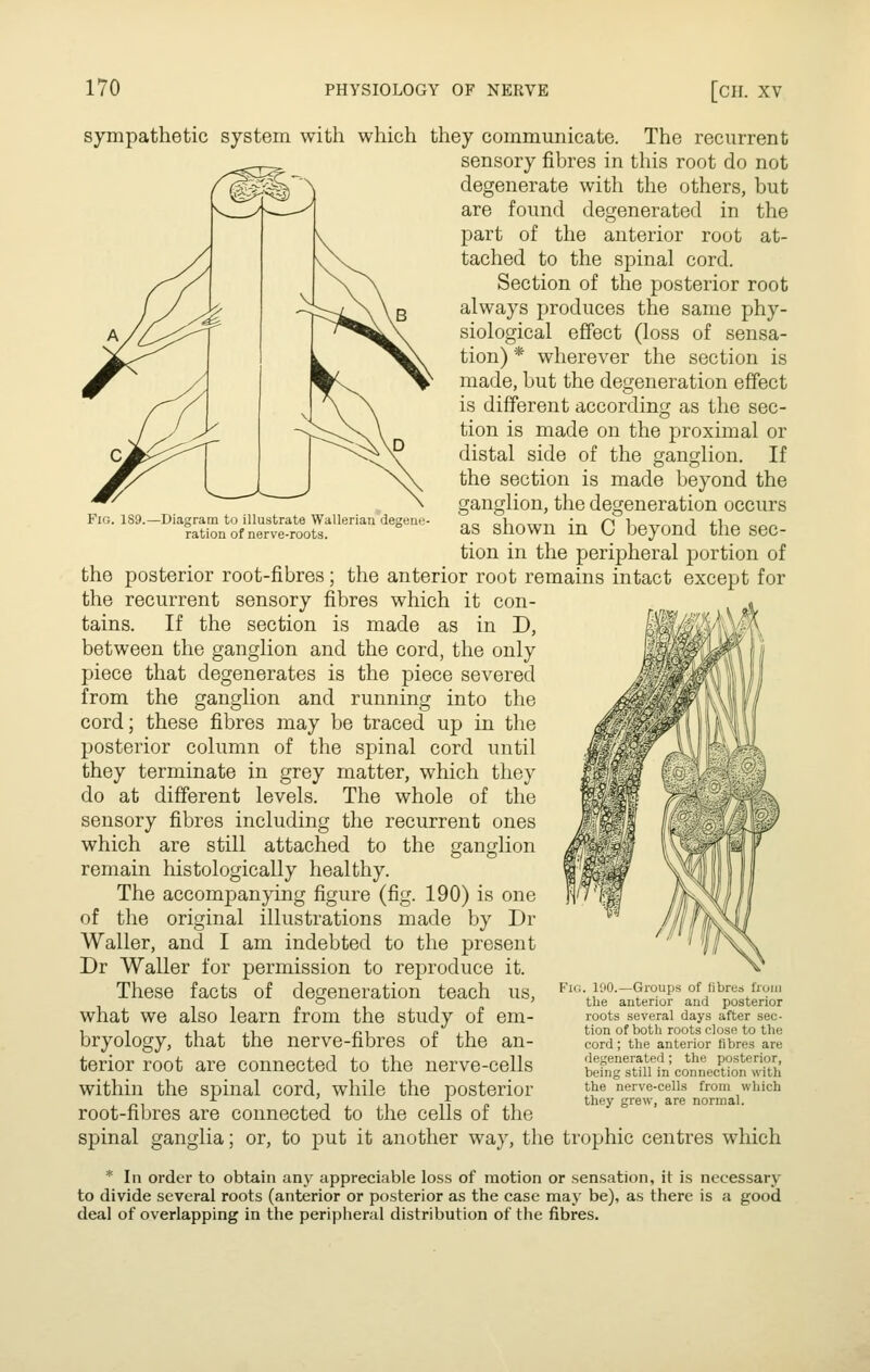 Fig. 189.^Diagram to illustrate Wallerian degem;- ration of nerve-roots. sympathetic system with which they communicate. The recurrent sensory fibres in this root do not degenerate with the others, but are found degenerated in the part of the anterior root at- tached to the spinal cord. Section of the posterior root always produces the same phy- siological effect (loss of sensa- tion) * wherever the section is made, but the degeneration effect is different according as the sec- tion is made on the proximal or distal side of the ganglion. If the section is made beyond the ganglion, the degeneration occurs as shown in C beyond the sec- tion in the peripheral portion of the posterior root-fibres; the anterior root remains intact except for the recurrent sensory fibres which it con- tains. If the section is made as in D, between the ganglion and the cord, the only piece that degenerates is the piece severed from the ganglion and running into the cord; these fibres may be traced up in the posterior column of the spinal cord until they terminate in grey matter, which they do at different levels. The whole of the sensory fibres including the recurrent ones which are still attached to the ganglion remain histologically healthy. The accompanying figure (fig. 190) is one of the original illustrations made by Dr Waller, and I am indebted to the present Dr Waller for permission to reproduce it. These facts of degeneration teach us, what we also learn from the study of em- bryology, that the nerve-fibres of the an- terior root are connected to the nerve-cells within the spinal cord, while the posterior root-fibres are connected to the cells of the spinal ganglia; or, to put it another way, the trophic centres which Fig. 190.—Groups of fibres from the anterior and posterior roots several days after sec- tion of both roots close to the cord; the anterior fibres are degenerated ; the posterior, being still in connection with the nerve-cells from which they grew, are normal. * In order to obtain any appreciable loss of motion or sensation, it is necessary to divide several roots (anterior or posterior as the case may be), as there is a good deal of overlapping in the peripheral distribution of the fibres.