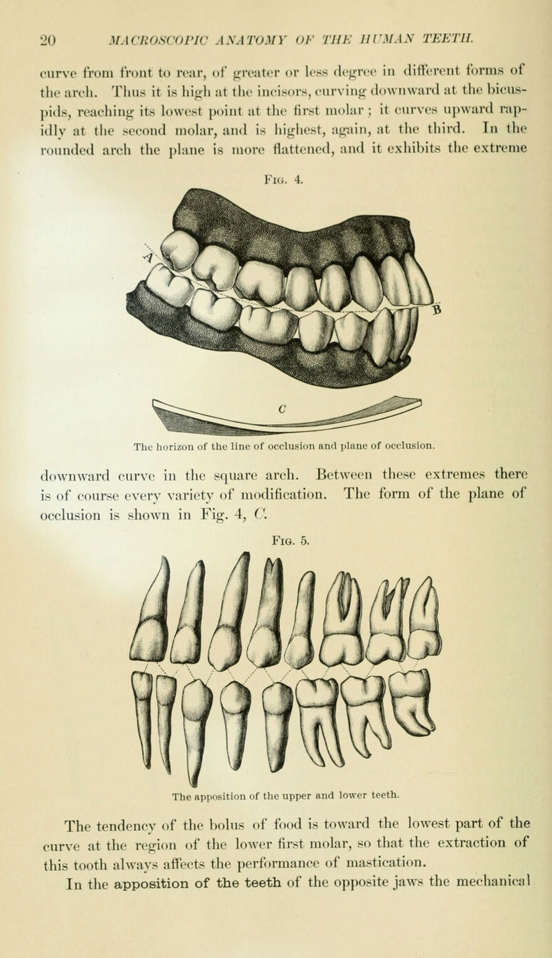 curve from front to rear, of (greater or less dogrcc in different forms of the arch. Thus it is hit^dj at the ineisors, curving downward at the bicus- pids, reaching its k)west ])()int at the first niokir; it cuirves upwanl raj)- idly at the second molar, and is highest, again, at the third. In the rounded arcli the pUme is more flattened, and it exhibits the extreme Fig. 4. The horizon of the line of occlusidn and plane of occlusion. downward curve in the square arch. Between these extremes there is of course every variety of modification. The form of the plane of occlusion is shown in Fig. 4, C Fig. 5. The apposition of the upper and lower teeth. The tendency of the bolus of food is toward the lowest part of the curve at the region of the lower first molar, so that the extraction of this tooth always affects the performance of mastication. In the apposition of the teeth of the opposite jaws the mechanical