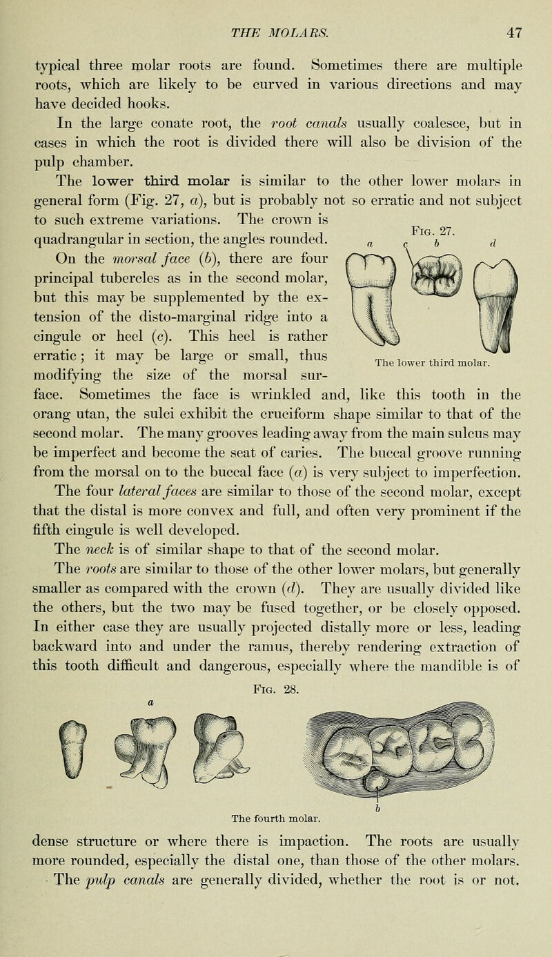 The lower third molar. typical three molar roots are found. Sometimes there are multiple roots, which are likely to be curved in various directions and may have decided hooks. In the large conate root, the root canals usually coalesce, but in cases in which the root is divided there will also be division of the pulp chamber. The lower third molar is similar to the other lower molars in general form (Fig. 27, a), but is probably not so erratic and not subject to such extreme variations. The crown is quadrangular in section, the angles rounded. On the morsal face (b), there are four principal tubercles as in the second molar, but this may be supplemented by the ex- tension of the disto-marginal ridge into a cingule or heel (c). This heel is rather erratic; it may be large or small, thus modifying the size of the morsal sur- face. Sometimes the face is wrinkled and, like this tooth in the orang utan, the sulci exhibit the cruciform shape similar to that of the second molar. The many grooves leading away from the main sulcus may be imperfect and become the seat of caries. The buccal groove running from the morsal on to the buccal face (a) is very subject to imperfection. The four lateral faces are similar to those of the second molar, except that the distal is more convex and full, and often very prominent if the fifth cingule is well developed. The neck is of similar shape to that of the second molar. The roots are similar to those of the other loAver molars, but generally smaller as compared with the crown (d). They are usually divided like the others, but the two may be fused together, or be closely opposed. In either case they are usually projected distally more or less, leading backward into and under the ramus, thereby rendering extraction of this tooth difficult and dangerous, especially where the mandible is of Fig. 28. The fourth molar. dense structure or where there is impaction. The roots are usually more rounded, especially the distal one, than those of the other molars. The pulp canals are generally divided, whether the root is or not.