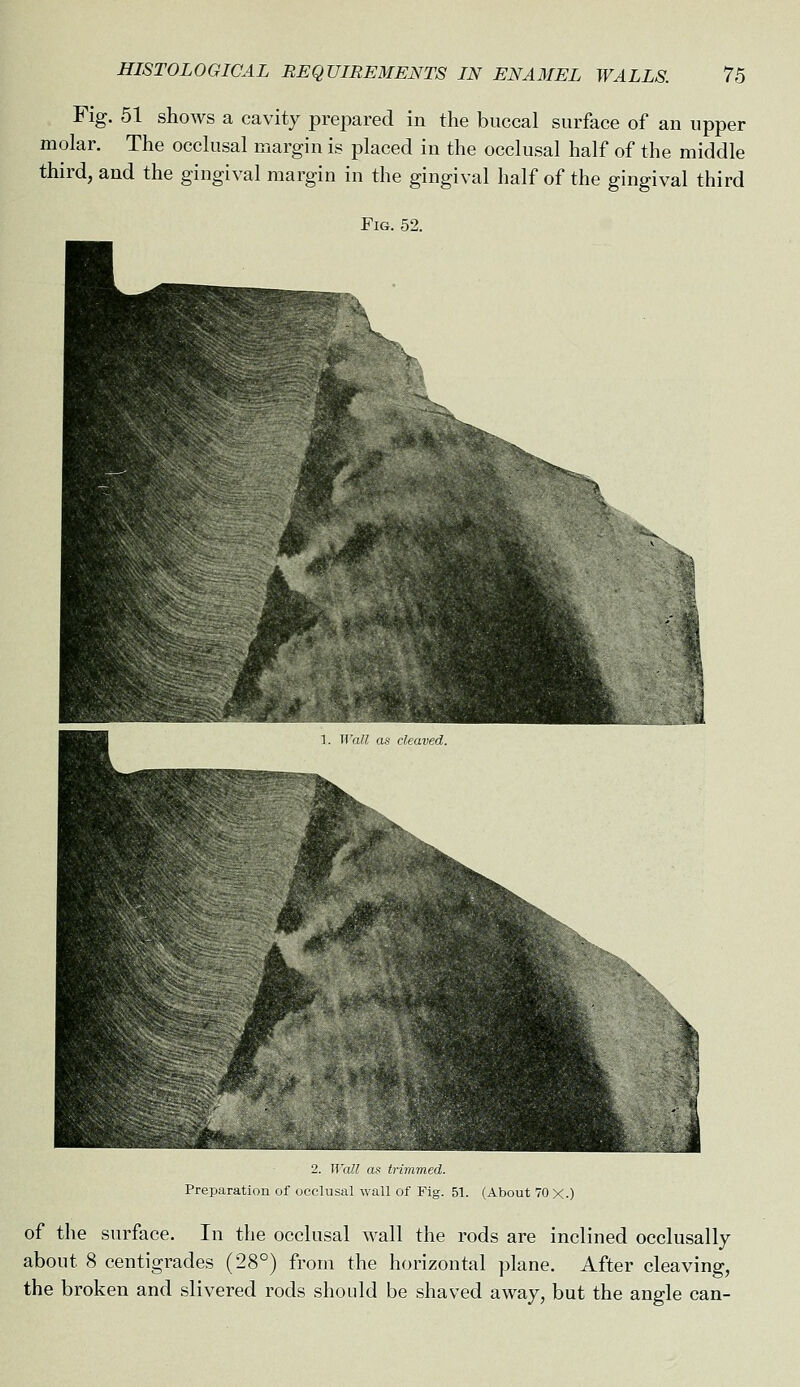 Fig. 51 shows a cavity prepared in the buccal surface of an upper molar. The occlusal margin is placed in the occlusal half of the middle third, and the gingival margin in the gingival half of the gingival third Fig. 52. 2. Wall as trimmed. Preparation of occlusal wall of Fig. 51. (About 70 X.) of the surface. In the occlusal wall the rods are inclined occlusally about 8 centigrades (28°) from the horizontal plane. After cleaving, the broken and slivered rods should be shaved away, but the angle can-