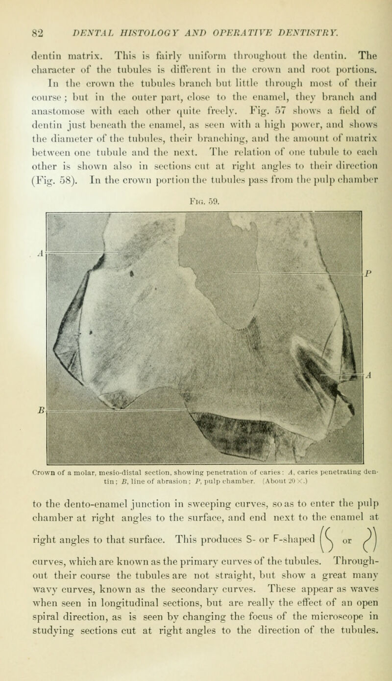 dentin matrix. This is fairly uiiifonn thnniiilioiit the (U-ntin. The character of the tubules is different in tiie crown and root portions. In the crown tlie tubules branch but little throuijh most of their course ; but in the outer part, close to the enamel, they branch and anastomose with each other (piite freely. Fig. 57 shows a held of dentin just beneath the enamel, as seen with a high power, and shows the diameter of the tubules, their branching, and the amount of matrix between one tubule and the next. The relation of one tubule to each other is shown also in sections cut at right angles to their direction (Fig. 58). In the crown portion the tubules pass from the pulp chamber Fk;. r)9. Crown of a molar, mesio-distal section, showing peiuiruti in t tin; B, line of abrasion : P. i>ulp cliainlnT. iliug den- Atioul JO ■ .) to the dento-enamel junction in sweeping curves, so as to enter the pulp chamber at right angles to the surface, and end next to the enamel at right angles to that surface. This produces S- or F-shaped \ or curves, which are known as the primary curves of the tubules. Through- out their course the tubules are not straight, but show a great many wavy curves, known as the secondary curves. These appear as waves when seen in longitudinal sections, but are really the effect of an open spiral direction, as is seen by changing the focus of the microscope in studying sections cut at right angles to the direction of the tubules.