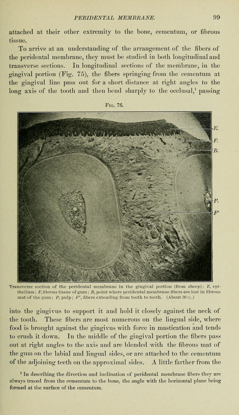 attached at their other extremity to the bone, cementum, or fibrous tissue. To arrive at an understanding of the arrangement of the fibers of the peridental membrane, they must be studied in both longitudinal and transverse sections. In longitudinal sections of the membrane, in the gingival portion (Fig. 75), the fibers springing from the cementum at the gingival line pass out for a short distance at right angles to the long axis of the tooth and then bend sharply to the occlusal,^ passing Fig. 76. Transverse section I'f the jioridental membrane in the gingival portion (from sheep): E, epi- thelium : /•; fibrous tissue of gum ; B, point where peridental membrane fibers are lost in fibrous mat of the gum; P, pulp; F', fibers extending from tooth to tooth. (About 30 X.) into the gingivus to support it and hold it closely against the neck of the tooth. These fibers are most numerous on the lingual side, where food is brought against the gingivus with force in mastication and tends to crush it down. In the middle of the gingival portion the fibers pass out at right angles to the axis and are blended with the fibrous mat of the gum on the labial and lingual sides, or are attached to the cementum of the adjoining teeth on the approximal sides. A little farther from the ^ In describing the direction and inclination of peridental membrane fibers they are always traced from the cementum to the bone, the angle with the horizontal plane being formed at the surface of the cementum.