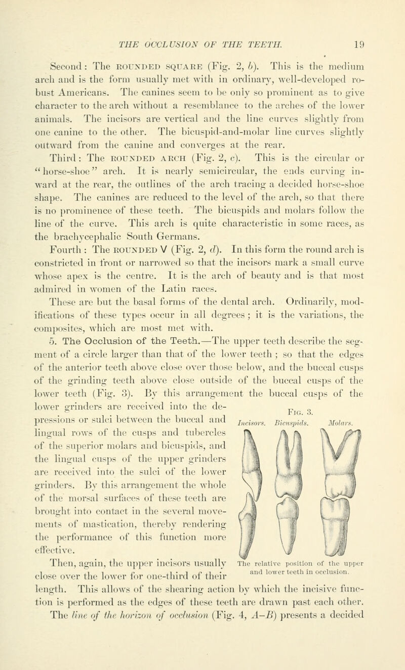 Second: The rounded square (Fig. 2, h). Tliis is the medium arch and is the form usually met with in ordinary, well-developed ro- bust Americans. The canines seem to be only so prominent as to give character to the arch without a resemblance to the arches of the lower animals. The incisors are vertical and the line curves slightly from one canine to the other. The bicus})id-and-molar line curves slightly outward from the canine and converges at the rear. Third : The ROUNDED ARCH (Fig. 2, c). This is the circular or ** horse-shoe arch. It is nearly semicircular, the ends curving in- ward at the rear, the outlines of the arch tracing a decided horse-shoe shape. The canines are reduced to the level of the arch, so that there is no prominence of these teeth. The bicuspids and molars follow the line of the curve. This arch is quite characteristic in some races, as the brachycephalic South Germans. Fourth : The rounded V (Fig. 2, d). In this form the round arch is constricted in front or narrowed so that the incisors mark a small curve whose apex is the centre. It is the arch of beauty and is that most admired in women of the Latin races. These are but the basal forms of the dental arch. Ordinarily, mod- ifications of these types occur in all degrees; it is the variations, the composites, which are most met with. 5. The Occkision of the Teeth.—The upper teeth describe the seg- ment of a circle larger than that of the lower teeth ; so that the edges of the anterior teeth above close over those below, and the buccal cusps of the grinding teeth above close outside of the buccal cusps of the lower teeth (Fig. 3). By this arrangement the buccal cusps of the lower grinders are received into the de- pressions or sulci between the buccal and lingual rows of the cusps and tubercles of the superior molars and bicuspids, and the lingual cusps of the upper grinders are received into the sulci of the lower grinders. By this arrangement the whole of the morsal surfaces of these teeth are brought into contact in the several move- ments of mastication, thereby rendering the performance of this function more effective. Then, again, the upper incisors usually close over the lower for one-third of their length. This allows of the shearing action by which the incisive func- tion is performed as the edges of these teeth are drawn past each other. The line of the horizon of occlusion (Fig. 4, ^1-^) presents a decided Incisors. Fig. 3. Bicuspids. Molar.' The relative position of tlie upper and lower teeth in occlusion.