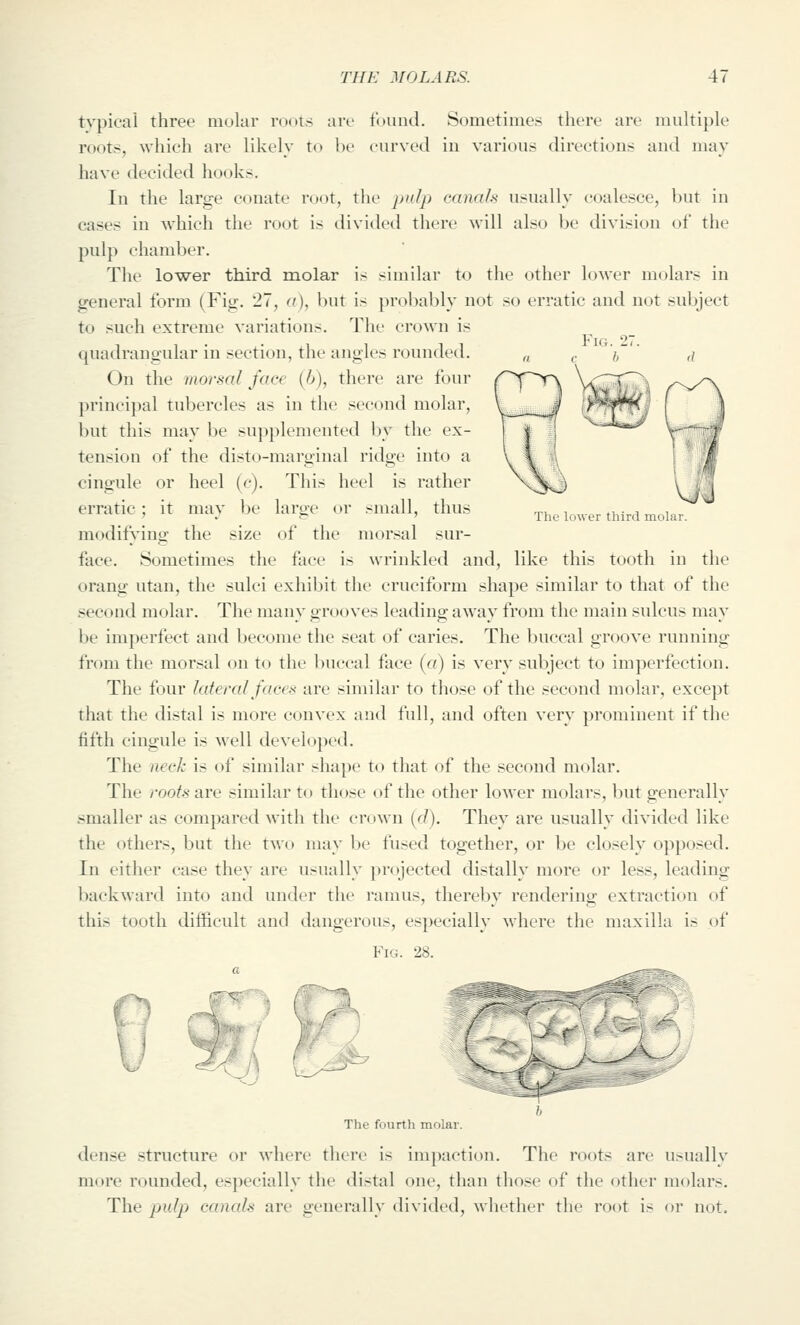 Fig. The lower third mobir. t>'pical three molar roots are found. Sometimes there are multiple roots, which are likely to be curved iu various directions and may have decided hooks. In the large conate root, the pulp canals usually coalesce, but in cases in which the root is divided there will also be division of the pulp chamber. The lower third molar is similar to the other loAver molars in general form (Fig, 27, u), but is probably not so erratic and not subject to such extreme variations. The crown is quadrangular in section, the angles rounded. On the morsal face [b), there are four principal tubercles as in the second molar, but this may be supplemented by the ex- tension of the disto-marginal ridge into a cingule or heel (c). This heel is rather erratic; it may be large or small, thus modifying the size of the morsal sur- face. Sometimes the face is wrinkled and, like this tooth in the orang utan, the sulci exhibit the cruciform shape similar to that of the second molar. The many grooves leading away from the main sulcus may be imperfect and become the seat of caries. The buccal groove running from the morsal on to the l)uccal face (a) is very subject to imperfection. The four lateral faces are similar to those of the second molar, except that the distal is more convex and full, and often very prominent if the fifth cingule is well developed. The neck is of similar shape to that of the second molar. The roots are similar to those of the other lower molars, but generally smaller as compared with the crown (cl). They are usually divided like the others, but the two may be fused together, or be closely opposed. In either case they are usually projected distally more or less, leading backward into and under the ramus, thereby rendering extraction of this tooth difficult and dangerous, especially where the maxilla is of Fig. 28. The fourth molar. dense structure or where there is impaction. The roots are usually more rounded, especially the distal one, than those of the other molars. The pulp canah are generally divided, whether the root is or not.