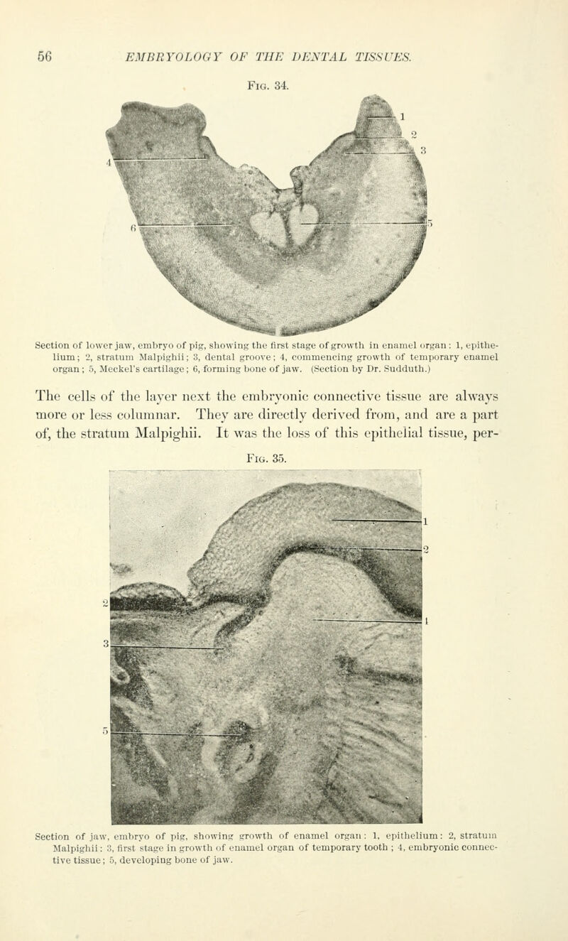 Fig. 34. .Hf^ Section of lower jaw, embryo of pig, sliowing lliu lirsl i^tage of growth in enaniel organ : 1, epithe- lium ; 2, stratum Malpighii; 3, dental groove; 4, commencing growth of temporary enamel organ ; 5, Meckel's cartilage; 6, forming bone of jaw. (Section by Dr. Sudduth.) The cells of the layer next the embryonic connective tissue are always more or less columnar. They are directly derived from, and are a part of, the stratum Malpighii. It was the loss of this epithelial tissue, per- FiG. 35. Section of jaw, embryo of pig, showing growth of enamel organ: 1, epithelium: 2, stratum Malpighii: 3, first stage in growth of enamel organ of temporary tooth ; 4, embryonic connec- tive tissue; 5, developing bone of jaw.