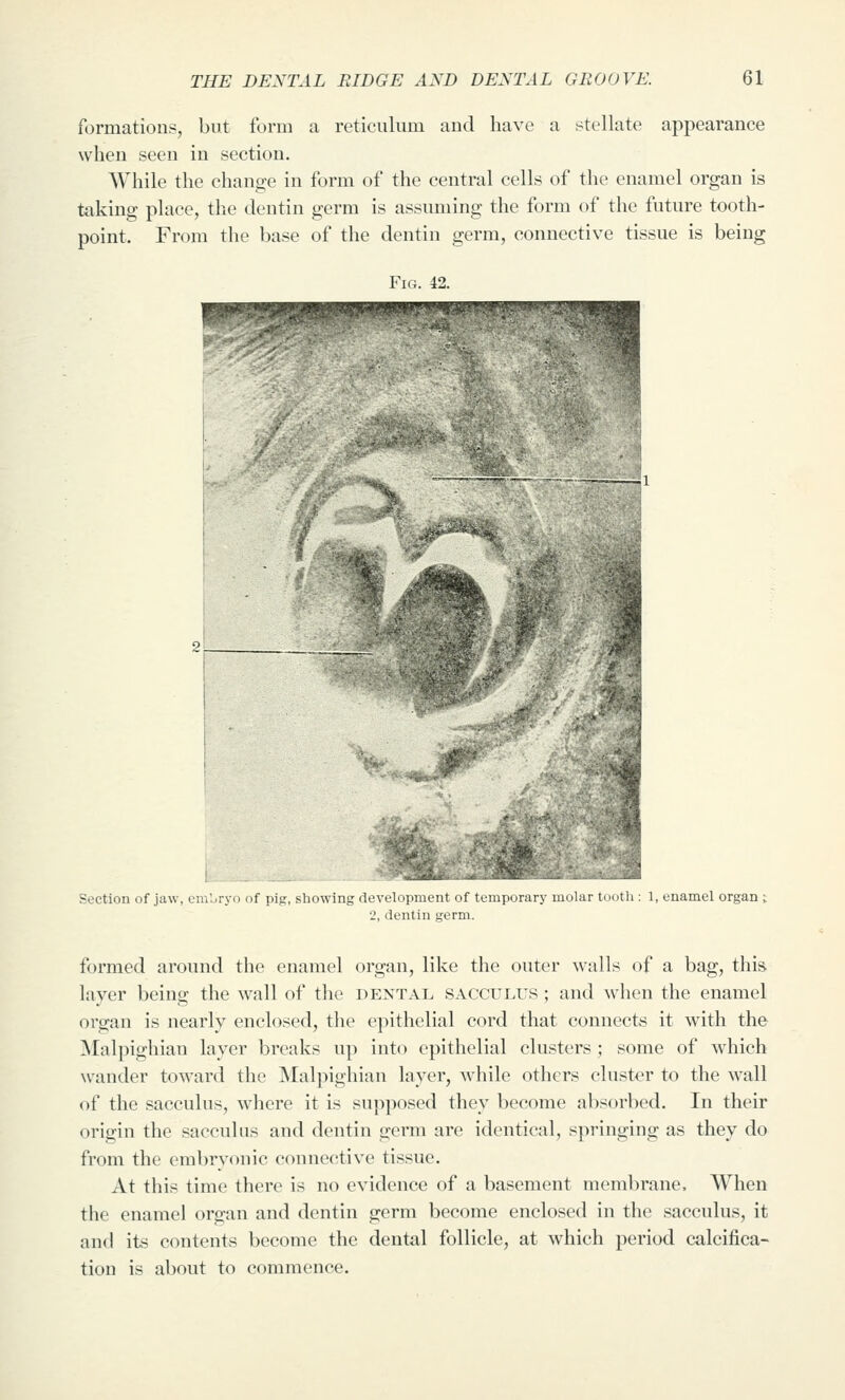 formations, but form a reticulum and have a stellate appearance when seen in section. While the change in form of the central cells of the enamel organ is tiiking place, the dentin germ is assuming the form of the future tooth- point. From the base of the dentin germ, connective tissue is being Section of jaw, embryo of pig, showing fU i(i. lary molar tooth : 1, enamel organ ; I, dentin germ. formed around the enamel organ, like the outer walls of a bag, this laver beino; the wall of the dental sacculus ; and when the enamel organ is nearly enclosed, the epithelial cord that connects it with the INIalpighian layer breaks up into epithelial clusters; some of which wander toward the INIalpighian layer, while others cluster to the wall of the sacculus, where it is supposed they become absorbed. In their origin the sacculus and dentin germ are identical, springing as they do from the embryonic connective tissue. At this time there is no evidence of a basement membrane. When the enamel organ and dentin germ become enclosed in the sacculus, it and its contents become the dental follicle, at which period calcifica- tion is about to commence.