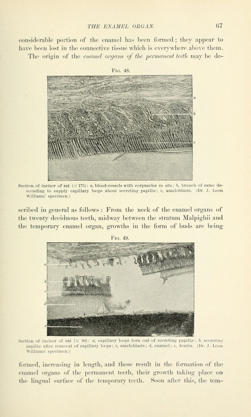 considerable portion of the enamel has been formed; they appear to have been lost in the connective tissne which is evervwhere above them. The origin of the enaind organs of tlie permanent teeth may be de- Frc. 4S. v\^jMwaji)  ,.J Section of incisor of rat ( ■' 175): a, blood-vessels with eorpuseles in situ; h, Ijraiieh of same de- scending to supply capillary loops about secreting papilla; c, ameloblasts. (Dr. J. LeoQ Williams* specimen.) scribed in general as follows : From the neck of the enamel organs of the twenty deciduous teeth, midway between the stratum Malpighii and the temporary enamel organ, growths in the form of buds are being Fig. 49. Section of incisor of rat (X 80): a, capillary loops torn out of secreting papillae; b, .secreting papillpe after removal of capillary loops; c, ameloblasts; d, enamel; e, dentin. (Dr. J. Leou Williams specimen.) formed, increasing in length, and these result in the formation of the enamel organs of the ])ermanent teeth, their grow^th taking place on the lingual surface of the temporary teeth. Soon after this, tlie tern-