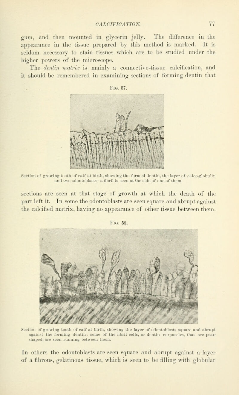 gum, and then mounted in glycerin jelly. The difiPereuce in the appearance in the tissue prepared by this method is marked. It is seldom necessary to stain tissues which are to be studied under the higher powers of the microscope. The dcnti)i matrix is mainly a connective-tissue calcification, and it should be remembered in examining sections of forming dentin that Fig. 57. 'S -^^fcvlllV-il**^-^ Plflffi^lli^. ^r' Section of growing tootli I'l' <air at lii and two odontoblasts th, shdw inu till' fiiniu'd ilriitiii, tlie layer of calco-globulin a fibril is seen at the side of one of them. sections are seen at that stage of growth at which the death of the part left it. In some the odontoblasts are seen square and abrupt against the calcified matrix, having no appearance of other tissue between them. Fig. 58. Section of growin;-' t i ith -i mW at birth, showing the layer of odontoblasts -luar. aiul abrui>t against the forming dentin; some of the fibril cells, or dentin corpuscles, that are pear- shaped, are seen running between them. In others the odontoblasts are seen square and abrupt against a layer of a fibrous, gelatinous tissue, which is seen to be filling with globular