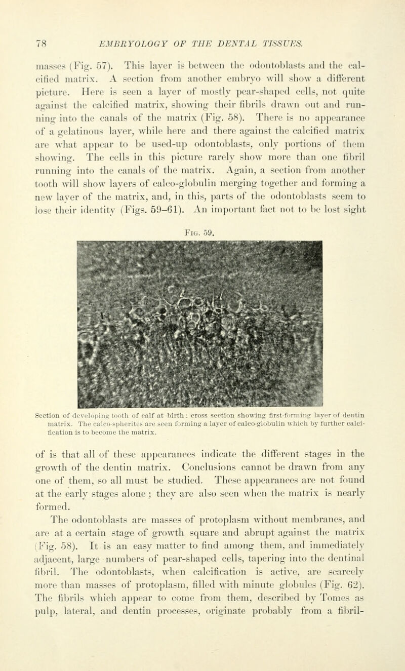 masses (Fig. 57). This layrr is hctwecn the odontoblasts and the cal- eifi(>d in:itrix. A section from another embryo will show a different picture. Here is seen a layer of mostly ])ear-sha|)('d cells, not (juite against the calcified matrix, showing their fibrils (h-:i\\ii out and I'un- ning into the canals of the matrix (Fig. 58). Thci-c is no appcarancse of a gelatinous layer, while here and there against the calcified matrix are what appear to be used-up odontoblasts, only portions of them showing. The cells in this picture rarely show more than one fibril running into the canals of the matrix. Again, a section from another tooth will show layers of calco-globulin merging together and forming a new laver of the matrix, and, in this, parts of the odontoblasts seem to lose their identity (Figs. 59-61). ^Vn irnjxu'tant fact not to be lost sight Fig. 59. .^V / ^'•^• ^ * :- Section of develoiiin.; ,.. ... ..i.. ..; ...it;.. .;..-,. .......i. ,-,...., .,,,u ,,i,-u..j,...;,- layrr of dentin matrix. The caleospherites are seen forming a layer of calco-globulin wliich by further calci- fication is to become the matrix. of is that all of these appearances indicate the different stages in the growth of the dentin matrix. Conclusions cannot be drawn from any one of them, so all must be studied. These appearances are not found at the early stages alone ; they are also seen when the matrix is nearly formed. The odontoblasts are masses of protoplasm without membranes, and are at a certain stage of growth square and abrupt against the matrix (Fig. 58). It is an easy matter to find among them, and immediately- adjacent, large numbers of pear-shaped cells, tapering into the dentinal fibril. The odontoblasts, when calcification is active, are scarcely more than masses of protoplasm, filled with minute globules (Fig. 62). The fibrils which appear to come from them, described by Tomes as pulp, lateral, and dentin processes, originate probably from a fibril-