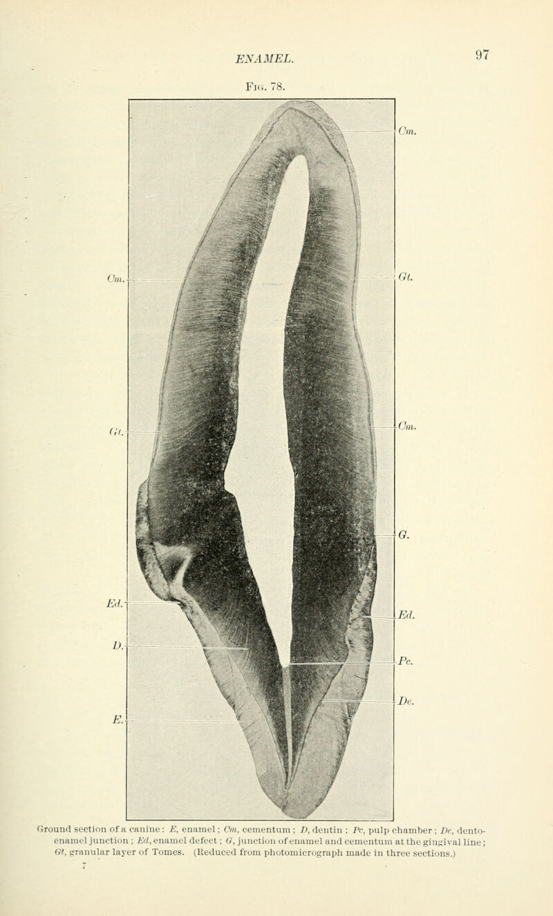 Fig. 78. 97 Cm. Ground section of a caninu : A, enamel; Cm, cementum ; T), dentin ; Pc, pulp chamber : De, dento- enamel junction ; Ed, enamel defect; U, junction of enamel and cementum at the ginsival line; Gt, snmular layer of Tomes. (Reduced from photomicrograph made in three sections.)