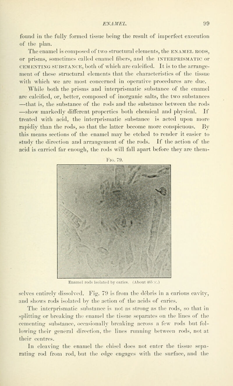 found in the fully formed tissue being the result of imperfect execution of the plan. The enamel is coni])()sed of two structural elements, the enamel rods, or prisms, sometimes called enamel fibers, and the interpeismatic or CEMENTING SUBSTANCE, both of which are calcified. It is to the arrange- ment of these structural elements that the characteristics of the tissue with \\hich we are most concerned in operative procedures are due. While both the prisms and interprismatic substance of the enamel are calcified, or, better, composed of inorganic salts, the two substances —that is, the substance of the rods and the substance between the rods —show markedly different properties both chemical and physical. If treated with acid, the interprismatic substance is acted upon more rapidly than the rods, so that the latter become more conspicuous. By this means sections of the enamel may be etched to render it easier to study the direction and arrangement of the rods. If the action of the acid is carried far enough, the rods will fall apart before they are them- FiG. 79. Enamol roils isolatL'd Ijv caries. (About li selves entirely dissolved. Fig. 79 is from the debris in a carious cavity, and show^s rods isolated by the action of the acids of caries. The interprismatic substance is not as strong as the rods, so that in splitting or breaking the enamel the tissue separates on the lines of the cementing sul)stance, occasionally breaking across a few rods but fol- lowing their general direction, the lines running between rods, not at their centres. In cleaving the enamel the eiiisel does not enter the tissue sepa- rating rod from rod, but the edge engages with the surface, and the