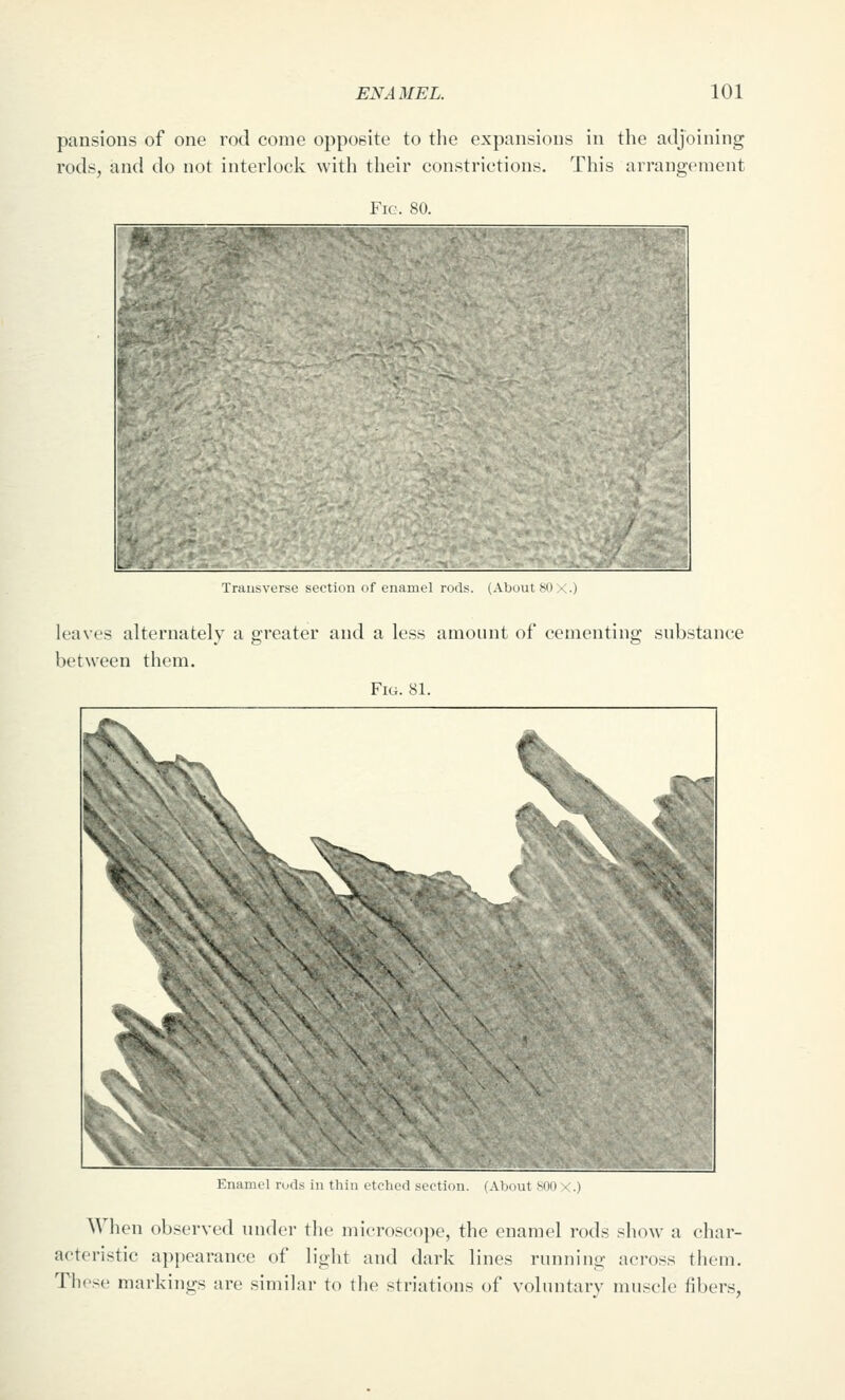 pansions of one rod come opposite to the expansions in the adjoining rods, and do not interlock with their constrictions. This arrangement Fic. 80. Trails verse bccti'jii of enamel rods. (About b' leaves alternately a greater and a less amonnt of cementing snbstance between them. Fig. 81. Enamel rods in thin etched section. (About SOO X.) AVhen observed under the microscope, the enamel rods show a char- acteristic appearance of light and dark lines running across tliem. Those markings are similar to the striations of voluntary muscle fibers,