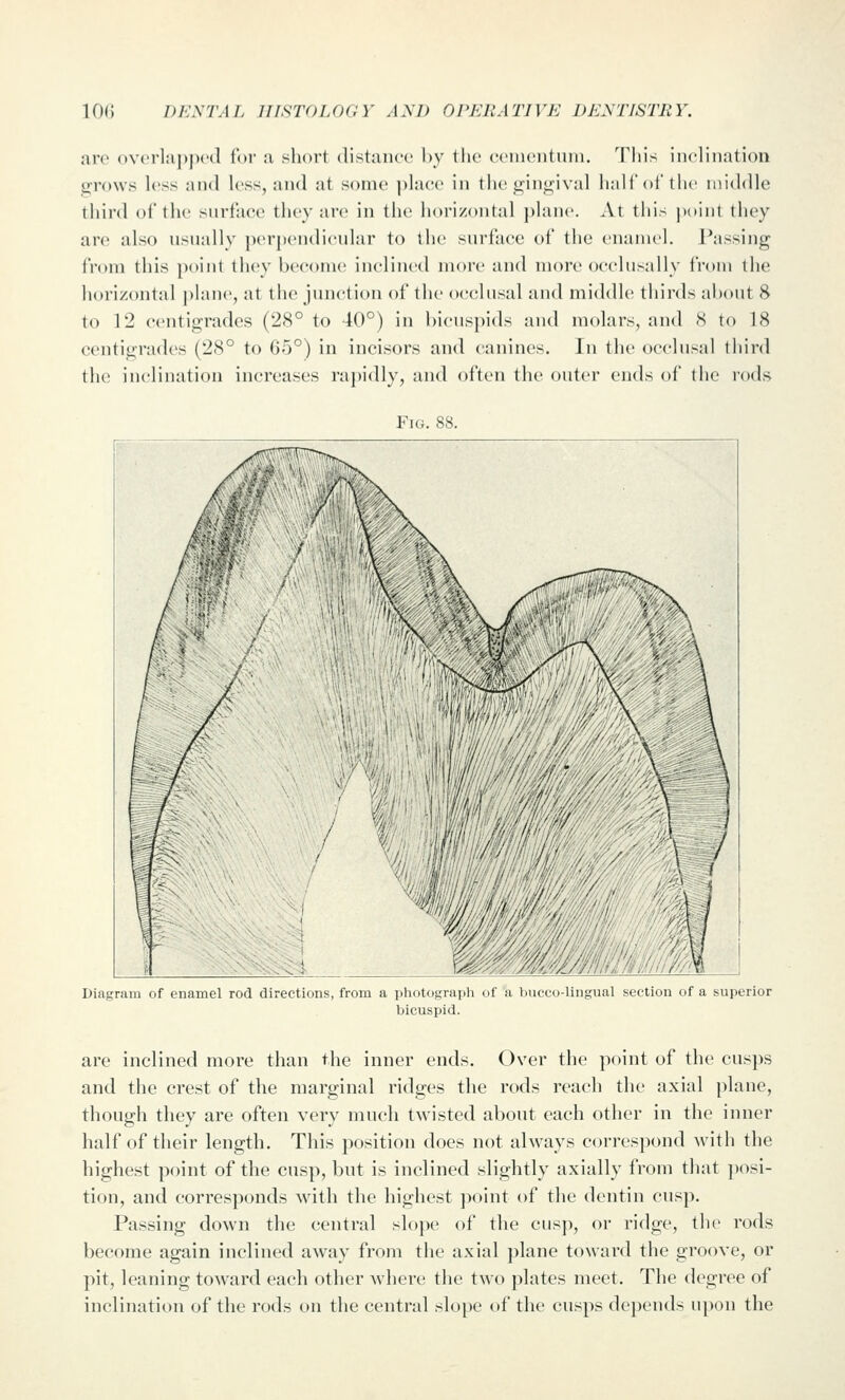 arc ()verlaj)jH'd lor a short distance by tlic ccinciituiu. Tliis inclination grows less and less, and at some ])lacc in tlie gingival liail'oftlic middle third of the surface they arc in the horizontal plane. At this point they are also usually per])endi('ular to the surface of the enamel. J^issing from this point they bcconu; inclined more and more occliisally from the horizontal |)lanc, at the junction of the occ^liisal and middle thirds about 8 to 12 centigrades (28° to 40°) in bicuspids and molars, and 8 to 18 centigradcs (28° to 65°) in incisors and canines. In the occlusal third the inclination increases rapidly, and often the outer ends of the rods Fig. 88. Diagram of enamel rod directions, from a photograyih of a buccolingual section of a superior bicuspid. are inclined more than the inner ends. Over the point of the cus])s and the crest of the marginal ridges the rods reach the axial plane, though they are often very much twisted about each other in the inner half of their length. This position does not always correspond with the highest point of the cusp, but is inclined slightly axially from that j)osi- tion, and corresponds with the highest ])()int of the dentin cusp. Passing down the central slope of the cusp, or ridge, the rods become again inclined aAvay from the axial plane toward the groove, or pit, leaning toward each other where the two plates meet. The degree of inclination of the rods on the central slope of the cusps de])ends upon the