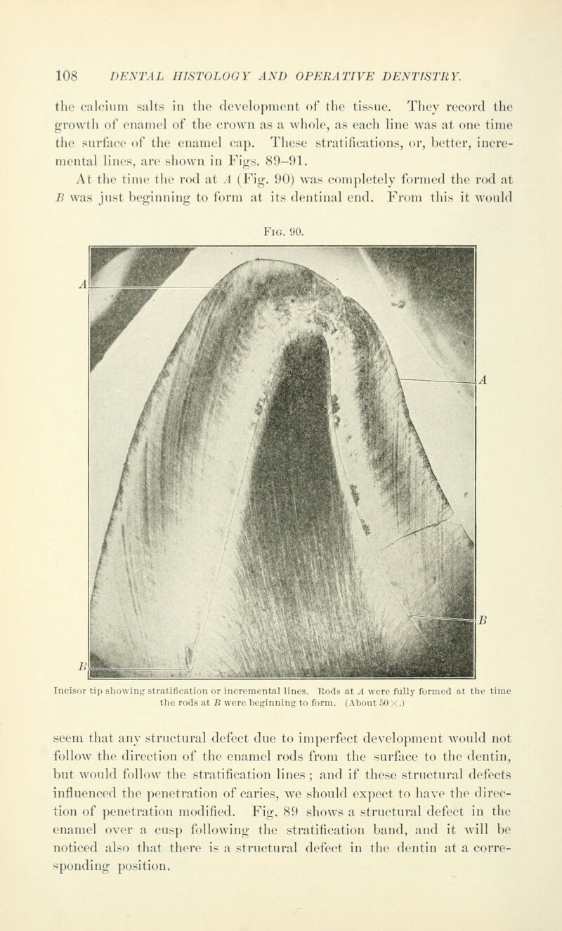 the calcium salts in the development of the tissue. They record the growth of (Miamel of the crown as a whole, as each line was at one time tlie surface of the enamel cap. These stratifications, or, better, incre- mental lines, are shown in Figs, 89-91. At the tim(> the rod at .1 (Fig. 90) was comphitely formed the rod at R was just beginning to form at its dentinal end. From this it would Fig. 90. Incisor tip sliowing stratification or incremental lines. Rods at A were fully formed at the time the rods at B were beginning to form. (About 50X.) seem that any structural defect due to imperfect development would not follow the direction of the enamel rods from the surface to the dentin, but would follow the stratification lines ; and if these structural defects influenced the penetration of caries, we should expect to have the direc- tion of penetration modified. Fig. 89 shows a structural defect in the enamel over a cusp following the stratification band, and it will be noticed also that there is a structural defect in the dentin at a corre- sponding position.