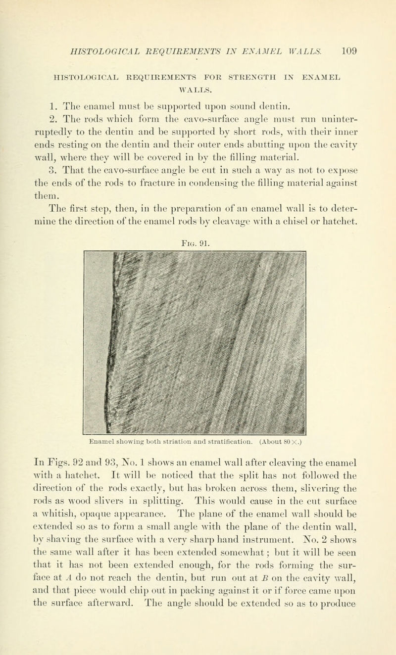 HISTOLOGICAL REQUIREMEXTS FOR STRENGTH IN ENAMEL WALLS. 1. The enamel must be supjwrted upon sound dentin. 2. The rods whicli form the cavo-surface angle must run uninter- ruptedly to the dentin and be supported by short rods, with their inner ends resting on the dentin and their outer ends abutting upon the cavity wall, where they will be covered in by the filling material. 3. That the cavo-surface angle be cut in such a way as not to expose the ends of the rods to fracture in condensing the filling material against them. The first step, then, in the preparation of an enamel wall is to deter- mine the direction of the enamel rods by cleavage with a chisel or hatchet. Fk;. ',n. Kuaincl hhuuiiii; buth >tiiuUiju ami stiutiliealiuu. (About 80X.) In Figs. 92 and 93, No. 1 shoAvs an enamel wall after cleaving the enamel with a hatchet. It will be noticed that the split has not followed the direction of the rods exactly, but has broken across them, slivering the rods as wood slivers in s])litting. This would cause in the cut surface a whitish, opaque appearance. The plane of the enamel wall should be extended so as to form a small angle with the plane of the dentin wall, by shaving the surfiice with a very sharp hand instrument. No. 2 shows the same wall after it has been extended somewhat; but it will be seen that it has not been extended enough, for the rods forming the sur- face at A do not reach the dentin, but run out at B on the cavity wall, and that piece would chip out in packing against it or if force came upon the surface afterward. The angle should be extended so as to produce