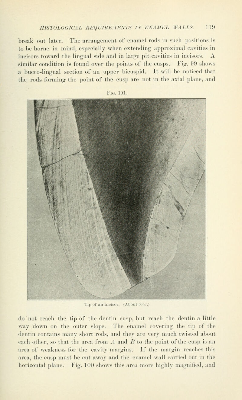 break out later. The arrangement of enamel rods in such positions is to be borne in mind, especially when extending approximal cavities in incisors toward the lingual side and in large pit cavities in incisors. A similar condition is found over the points of the cusps. Fig. 99 shows a bucco-lingual section of an upper bicuspid. It will be noticed that the rods forming the point of the cusp are not in the axial plane, and Fi(i. 101. Till 'jf 'I iuciMir. I About 50 X.) do not reach the tip of the dentin cusp, but reach the dentin a little way down on the outer slope. The enamel covering the tip of the dentin contains many short rods, and they are very much twisted about each other, so that the area from A and B to the point of the cusp is an area of weakness for the cavity margins. If the margin reaches this area, the cusp must be cut away and the enamel wall carried out in the horizontal plane. Fig. 100 shows this area more highly magnified, and