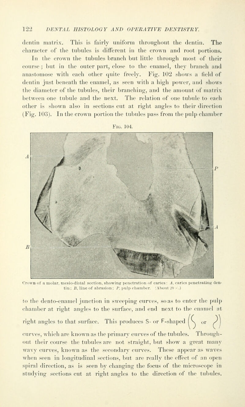 dentin niati'ix. Tliis is lairly iinif'onn thn)U<;li()nt tlu; dentin. Tlie character of the tubuk's is diffcirent in tlie crown and root portions. In the crown tlie tnbides hrancli bnt little lhron<>h most of their course ; but in the outer j)art, close to the enamel, they branch and anastomose with each other (juitc freely. I i^. 102 shows a held of dentin just beneath the enamel, as seen with a high jM)wer, and shows the diameter of the tubides, their branching, and the amount of nuitrix between one tubule and the next. The relation of one tubule to each other is shown also in sections cut at right angles to their direction (Fig. 103). In the crown portion the tubules pass from the pulp chamber Fig. 104. Criiwn 111 a ninl.-ir, iiirsii)ili;-lal Sfctimi, shuwiiiL,' iiein.'tratKni ^f caru ;- : .1, carits )iLiiL-truUii,L; ilen- tin; />, line cif abrasion ; 7', iiiilji cIimiuIjlt. ;Ahoiit jn .) to the dento-enamel junction in sweeping curves, so as to enter the pulp chamber at right angles to the surface, and end next to the enamel at right angles to that surface. This produces S- or F-shaped \ or /] curves, which are known as the primary curves of the tubules. Through- out their course the tubules are not straight, but shoAV a great many wavy curves, known as the secondary curves. These appear as waves when seen in longitudinal sections, but are really the effect of an open spiral direction, as is seen by changing the focus of the microscojie in studying sections cut at right angles to the direction of the tubules.