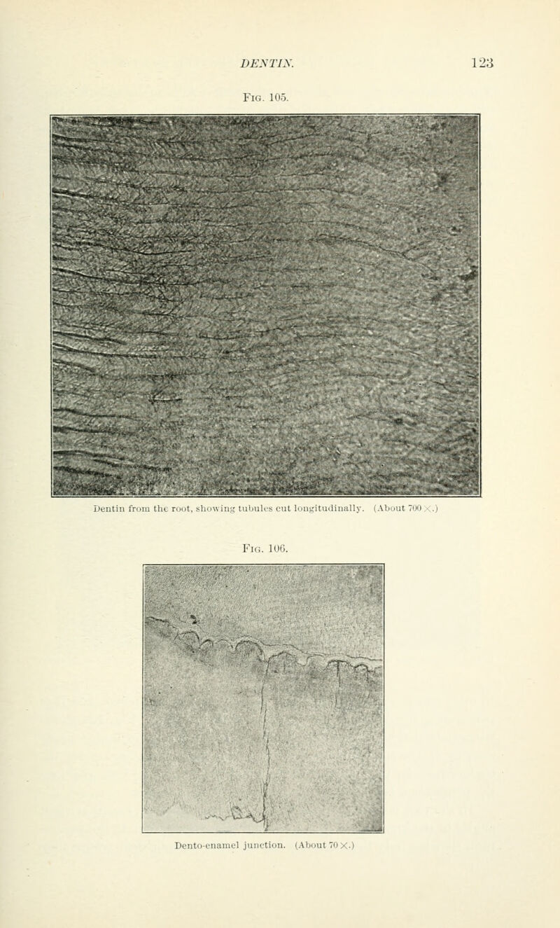 DEyTIX. Fig. 105. 12a Ueutiii from the root, showing tubuK's cut lungitudinally. (.Vbuut 700 ,\.) Fin. lob Dento-enamel juiu'tion. (AVjout70X.)