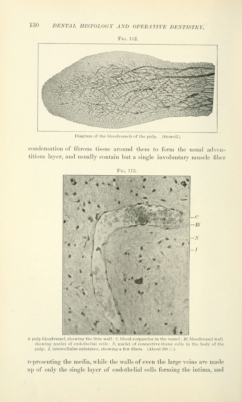 Fi(i. 112. -,'*jssa« Diagram of Utv IiIihmUx-ssuIs of the pulp. (Stowell.) condensation of fibrous tissue around tlieni to form the usual adven- titious layer, and usually contain but a single involuntary muscle fiber Fu.. li:i *:# * , * *< V *-4 %•» i« A pulp bloodvessel, showing tin,- tliiii wall: C, blood CDrjiustlLS in tlio vessel; 1)1, bloodvessel wall showing nuclei of endothelial cells; K, nuclei of connective-tissue cells in the body of the pulp; I, intercellular substance, showing a few fibers. (About 200 >C.) representing the media, while the walls of even the large veins are made up of only the single layer of endothelial cells forming the intima, and