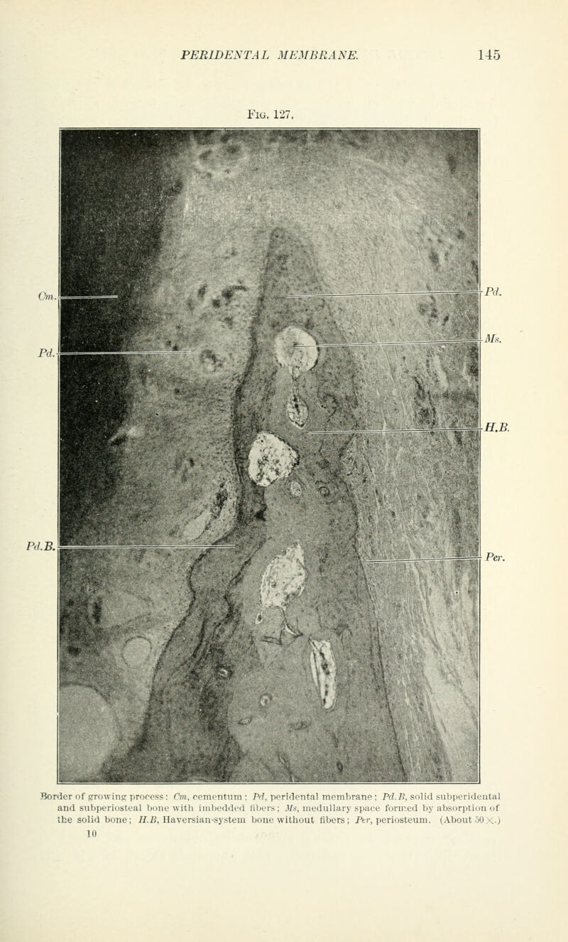 Fig. 127. H.B. Pd.B. Border of growins; process : Tm, oemcntum ; Prf, peridental membrane: Prf.B, solid subperidental and subperiosteal bone witli imbedded fibers; J/.s, medullary space formed by absorption of the solid bone; //.£, Haversian-system bone without fibers; Ptr, periosteum. (About 50X-J 10