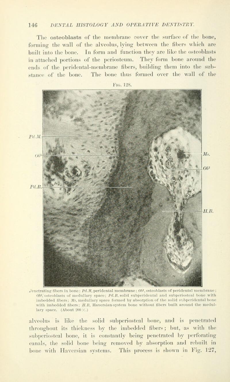 The osteoblasts of the inenibi-aiic cover tlie siirlace of llic l)one, formiiiii; tlie wall of the alveolus, lyinji; between the libers which are built into the bone. In form and function they arc like the osteoblasts in attached portions of the periosteum. They form bone around the ends of the peridental-membrane fibers, buildiui^ them into the sub- stance of the bone. The bone thus formed over the wall of the Fk;. 12S. rd.M. Bl.Il H.B. r'enetrating; fibers in bone : Pd.M, peridental membrane ; OW, osteoblasts of peridental membrane : 062, osteoblasts of medullary space; Pd.B, solid subperidental and subperiosteal bone with imbedded fibers; il/s, medullary space formed by absorption of the solid subperidental bone with imbedded fibers; H.B, Haversian-system bone without fibers built around the medul- lary space. (About 200 X.) alveolus is like the solid subperiosteal bone, and is penetrated throughout its thickness by the imbedded fibers; but, as with the subperiosteal bone, it is constantly being penetrated by perforating canals, the solid bone being removed by absorption and rebuilt in bone with Haversian systems. This process is shown in Fig. 127,