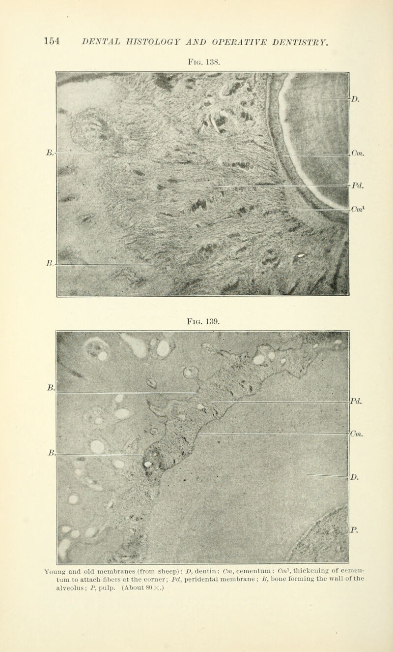 Fig. 138. Fig. 139. Young and old membranes (from sheep): 1>, dentin: Cm, cementum: (';»', thickening of eenien- tiim to attach fibers at the corner; Pd, peridental membrane ; B, boue forming the wall of the alveolus; P, pulp. (About 80 X.)
