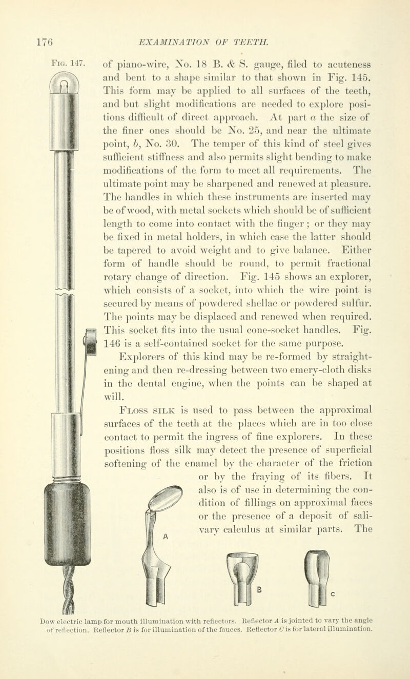 of piano-wire, No. 18 B. & S. gauge, filed to acuteness and bent to a shape similar to that shown in Fig. 145. This form may be ap])lied to all surfaces of the teeth, and but slight modifications are needed to explore posi- tions difficult of direct approach. At part a the size of the finer ones should be No. 25, and near the ultimate point, h, No. 30. The temper of this kind of steel gives sufficient stiffness and also ])ermits slight bending to make modifications of the form to meet all requirements. The ultimate point may be sharpened and renewed at pleasure. The handles in which these instruments are inserted may be of wood, with metal sockets which should be of sufficient length to come into contact with the finger; or they may be fixed in metal holders, in which case the latter should be tapered to avoid weight and to give balance. Either form of handle should be round, to permit fractional rotary change of direction. Fig. 145 shows an explorer, which consists of a socket, into Avhich the wire point is secured by means of powdered shellac or powdered sulfur. The points may be displaced and renewed M'hen required. This socket fits into the usual cone-socket handles. Fig, 146 is a self-contained socket for the same purpose. Explorers of this kind may be re-formed by straight- ening and then re-dressing between two emery-cloth disks in the dental engine, when the points can be shaped at will. Floss silk is used to pass between the approximal surfaces of the teeth at the places which are in too close contact to permit the ingress of fine explorers. In these positions floss silk may detect the presence of superficial softening of the enamel by the character of the friction or by the fraying of its fibers. It also is of use in determining the con- dition of fillings on approximal faces or the presence of a deposit of sali- vary calculus at similar parts. The Dow electric lamp for mouth illumination with reflectors. Reflector A is jointed to vary the angle of reflection. Reflector B is for illumination of the fauces. Reflector Cls for lateral illumination.