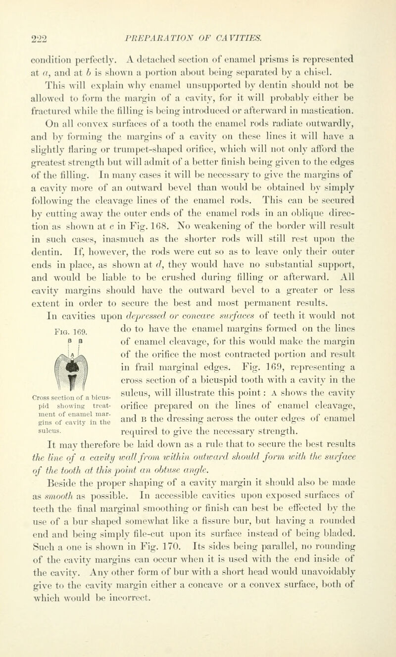 condition perfectly. A (Ictacheil section of enamel j)risnis is represented at (/, and at h is slu)\vn a portion about being separated by a chisel. This will explain why enamel unsupported by dentin should not be allowed to form the margin of a cavity, for it will probably either be fractured while the filling is being introduced or afterward in mastication. On all convex surfaces of a tooth the enamel rods radiate outwardly, and by forming the margins of a cavity on these lines it will have a slightly flaring or trumpet-shaped orifice, which will not only afford the greatest strength but will admit of a Ix'tter finish being given to the edges of the filling. In many cases it will be necessary to give the margins of a cavity more of an outward bevel than would be obtained by simply followino- the cleavao-e lines of the enamel rods. This can be secured by cutting away the outer ends of the enamel rods in an oblicpie direc- tion as shown at c in Fig. 168. No weakening of the border will result in such cases, inasmuch as the shorter rods will still rest upon the dentin. If, however, the rods were cut so as to leave only their outer ends in place, as shown at d, they would have no substantial support, and would be liable to be crushed during filling or afterward. All cavity margins should have the outward bevel to a greater or less extent in order to secure the best and most permanent results. In cavities upon depressed or concave surfaces of teeth it would not Fig. 169 ^^ ^^ have the enamel margins formed on the lines P B of enamel cleavage, for this would make the margin of the orifice the most contracted portion and result in frail marginal edges. Fig. 169, representing a cross section of a bicuspid tooth with a cavity in the ,. ^ ,. sulcus, will illustrate this point: A shows the cavitv Cross section of a bicus- ' i pid showing treat- orifice prepared on the lines of enamel cleavage, ment of enamel mar- i xi i • xi, i. i x' i gins of cavity in the ^^^^^ ^ ^'^^ dressing across the outer edges of enamel sulcus. required to give the necessary strength. It may therefore be laid down as a rule that to secure the best results the line of a cavity wall from ivithin outward should form with tlie surface of the tooth at this point an obtuse angle. Beside the proper shaping of a cavity margin it should also be made as smooth as possible. In accessible cavities upon exposed surfaces of teeth the final marginal smoothing or finish can best be effected by the use of a bur shaped somewhat like a fissure bur, but having a rounded end and being simply file-cut upon its surface instead of being bladed. Such a one is shown in Fig. 170. Its sides being parallel, no rounding of the cavity margins can occur when it is used with the end inside of the cavity. Any other form of bur with a short head would unavoidably give to the cavity margin either a concave or a convex surface, both of which would be incorrect.