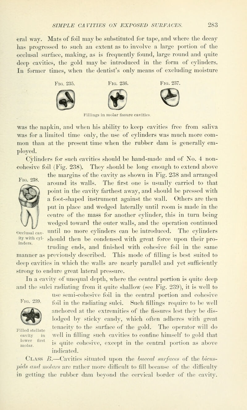 eral way. Mats of foil may be substituted for tape, and where the decay has progressed to such an extent as to involve a large portion of the occlusal surface, making, as is frequently found, large round and quite deep cavities, the gold may be introduced in the form of cylinders. In former times, when the dentist's only means of excluding moisture Fio. 235. Fig. 236. Fig. 237. Fig. 238. Occlusal cav- ity with cyl- inders. Fillings in molar fissure cavities. was the napkin, and when his ability to keep cavities free from saliva was for a limited time only, the use of cylinders was much more com- mon than at the present time when the rubber dam is generally em- ployed. Cylinders for such cavities should be hand-made and of No. 4 non- cohesive foil (Fig. 238). They should be long enough to extend above the margins of the cavity as shown in Fig. 238 and arranged around its walls. The first one is usually carried to that point in the cavity farthest away, and should be pressed with a foot-shaped instrument against the wall. Others are then })ut in place and wedged laterally until room is made in the centre of the mass for another cylinder, this in turn being wedged toward the outer walls, and the operation continued until no more cylinders can be introduced. The cylinders should then be condensed with great force upon their pro- truding ends, and finished with cohesive foil in the same manner as previously described. This mode of filling is best suited to deep cavities in which the walls are nearly parallel and yet sufficiently strong to endure great lateral pressure. In a cavity of unequal depth, where the central portion is quite deep and the sulci radiating from it quite shallow (see Fig. 239), it is well to use semi-cohesive foil in the central portion and cohesive foil in the radiating sulci. Such fillings require to be well anchored at the extremities of the fissures lest they be dis- lodged by sticky candy, which often adheres with great tenacity to the surface of the gold. The operator will do well in filling such cavities to confine himself to gold that is quite cohesive, except in the central portion as above indicated. Class B.—Cavities situated uj^on the buccal surfaces of the bicus- pids and molars are rather more difficult to fill because of the difficulty in getting the rubber dam beyond the cervical border of the cavity. Fig. 239. Filled stellate cavity in lower first molar.